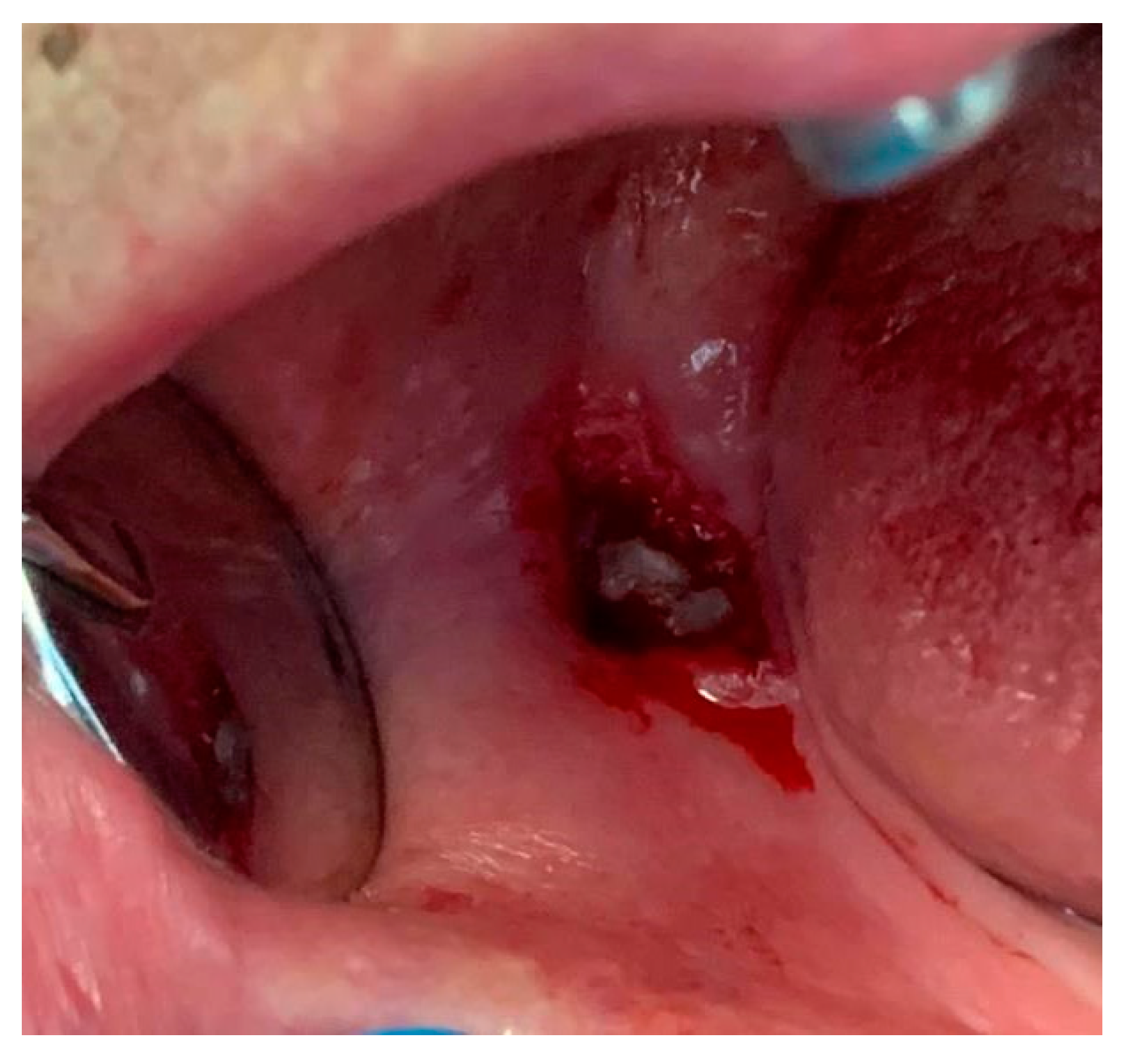 Diagnostics 12 02082 g004 Diagnostics 12 02082 g004