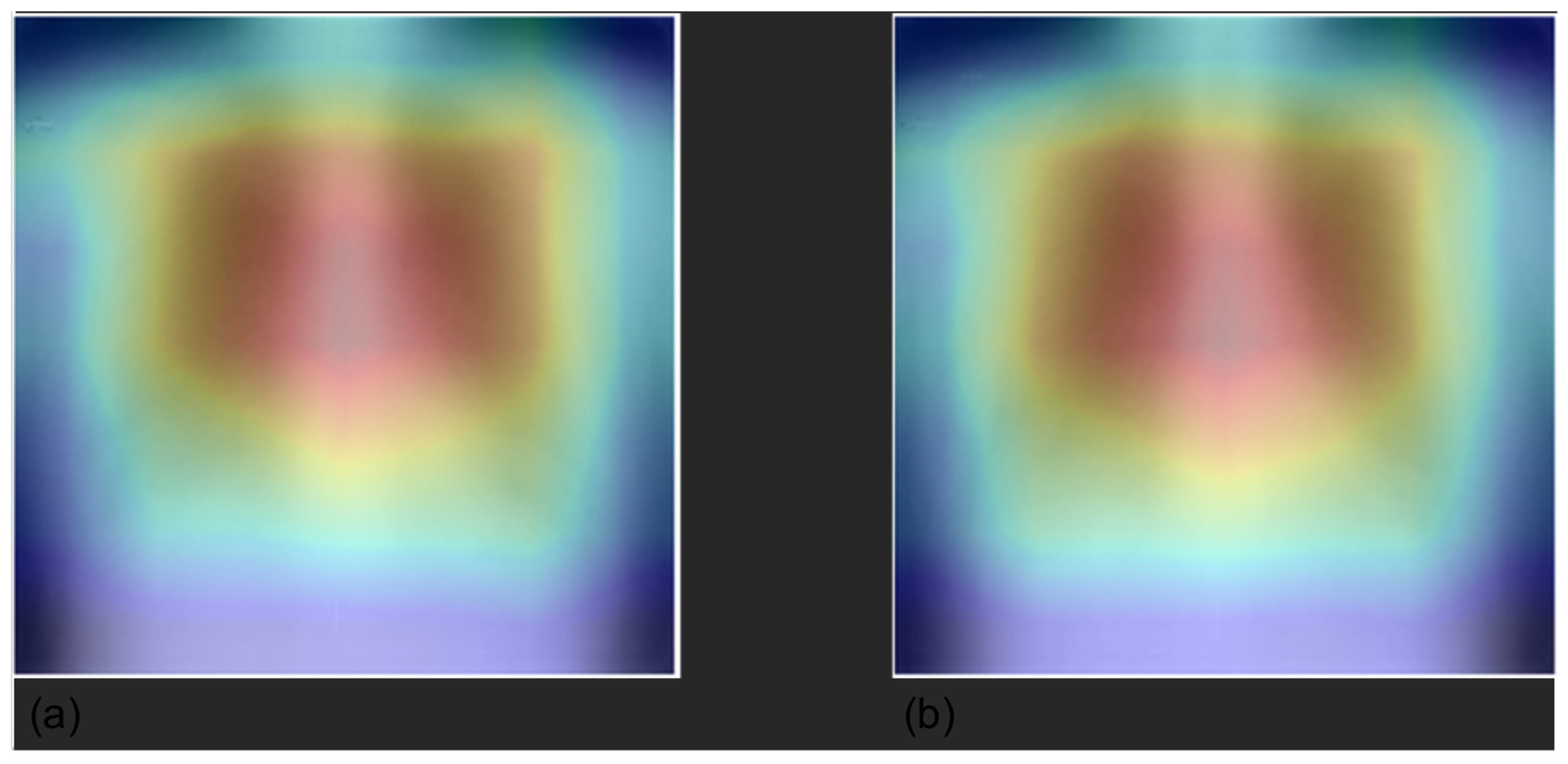 Diagnostics 12 02084 g003 550