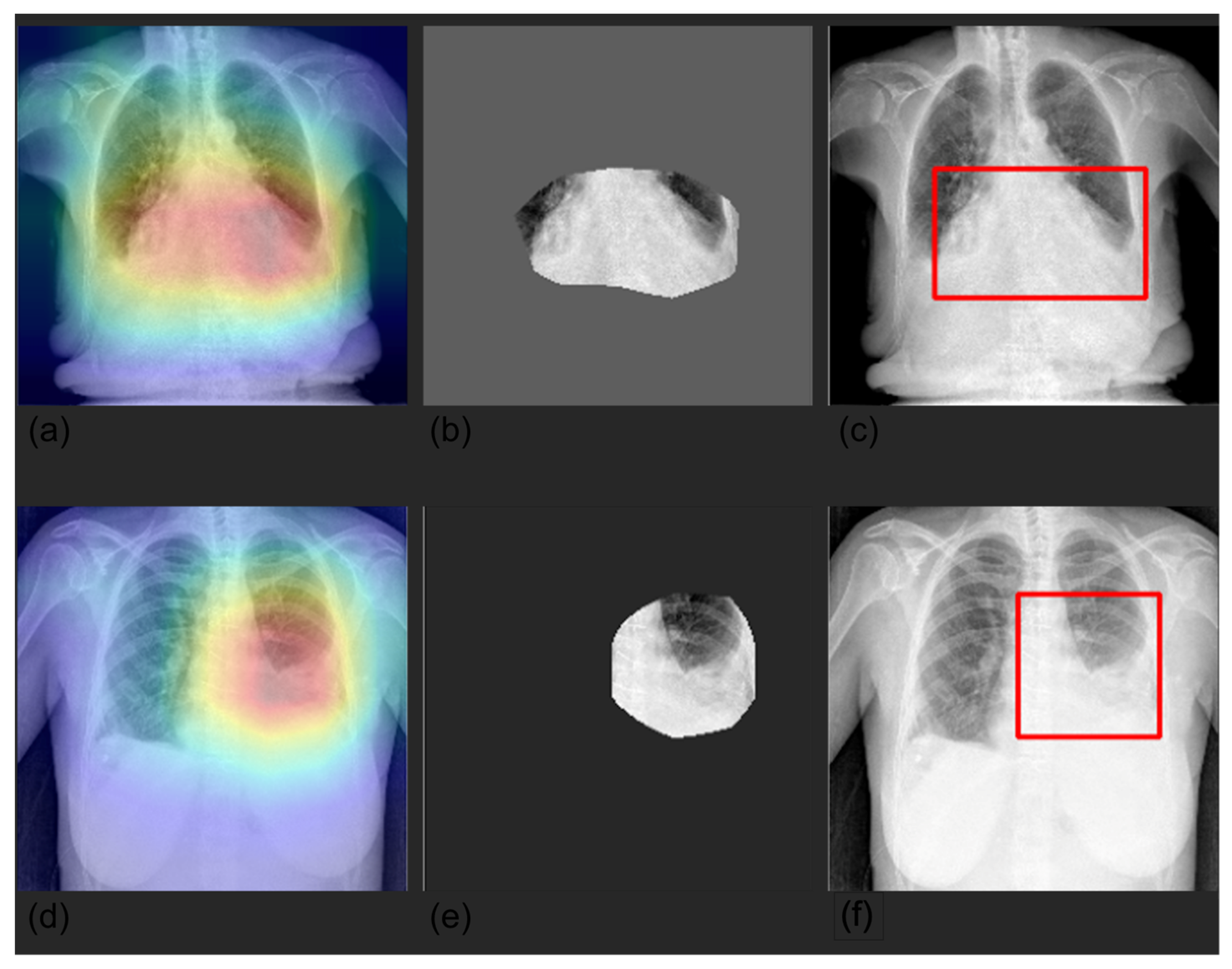 Diagnostics 12 02084 g004 550