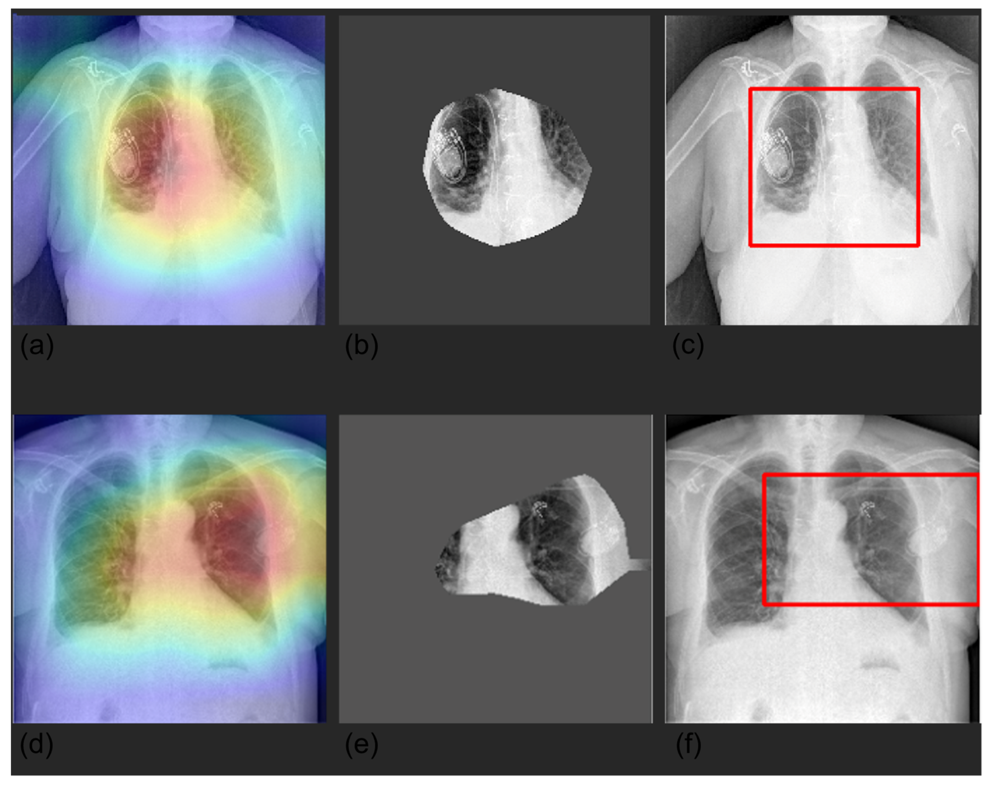 Diagnostics 12 02084 g005 550
