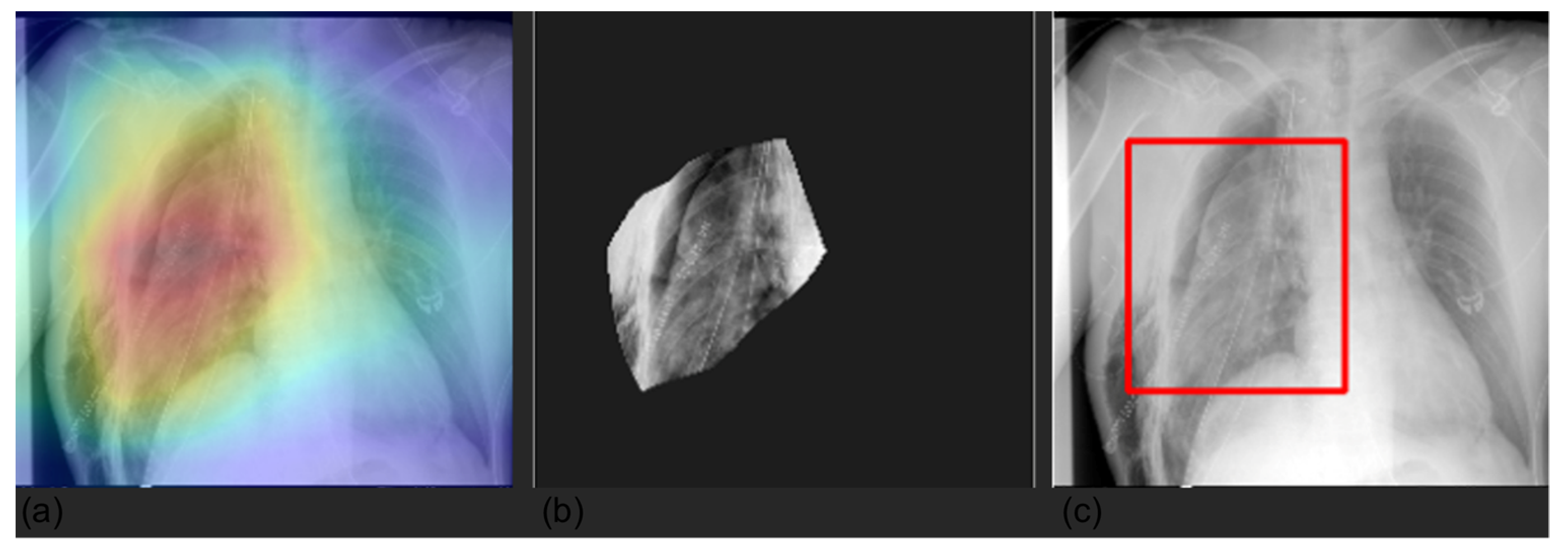 Diagnostics 12 02084 g006 550