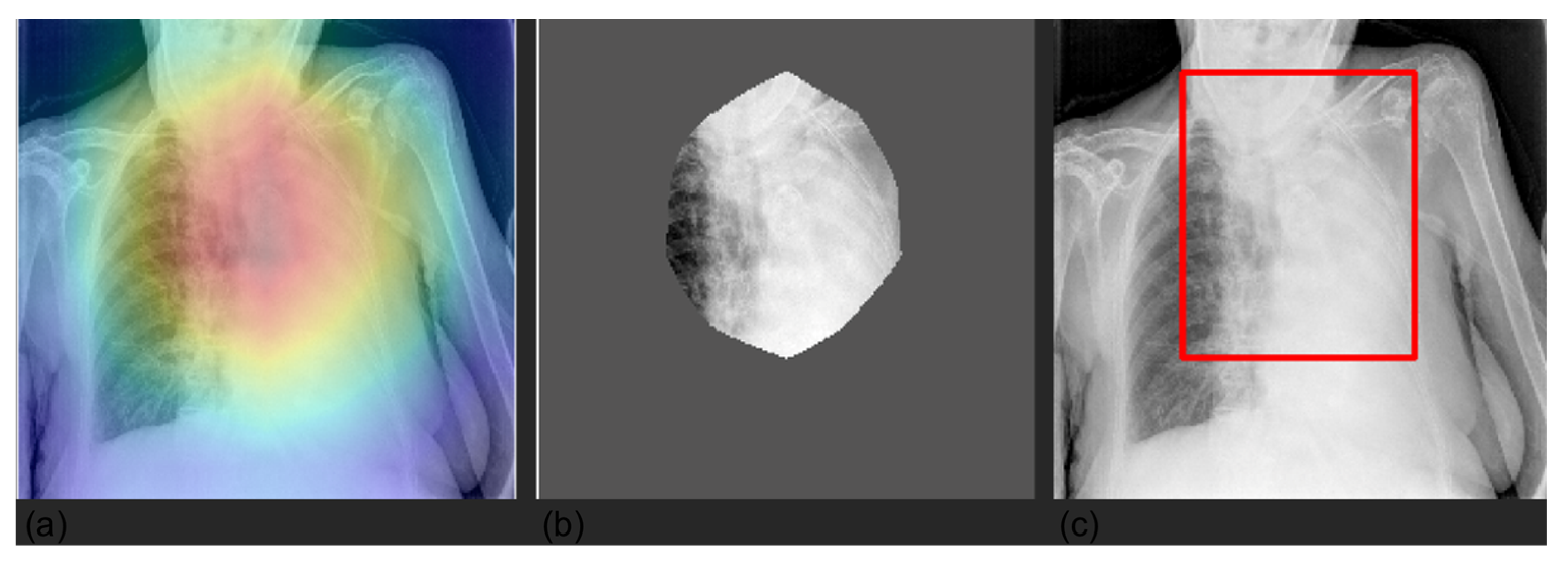 Diagnostics 12 02084 g007 550