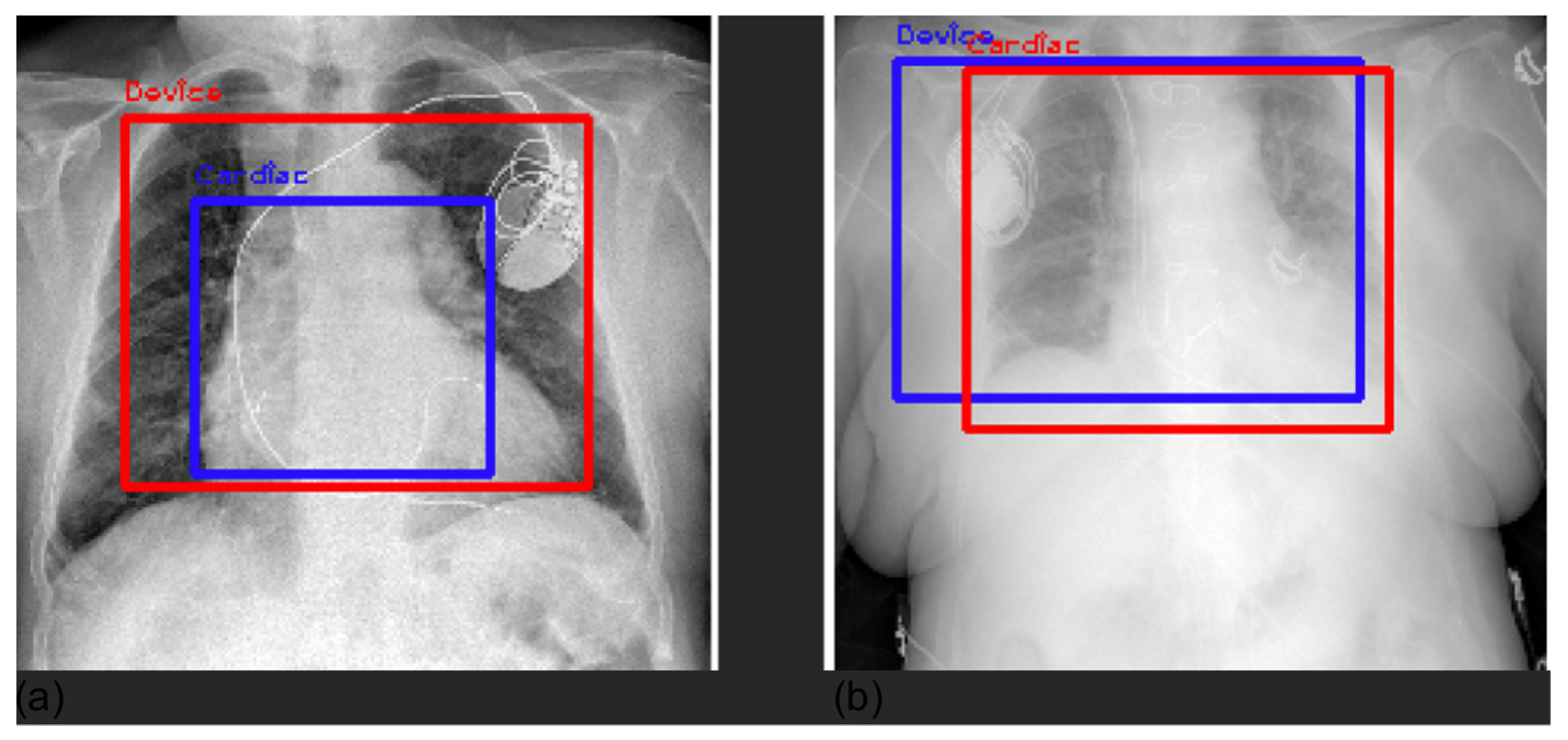 Diagnostics 12 02084 g008 550