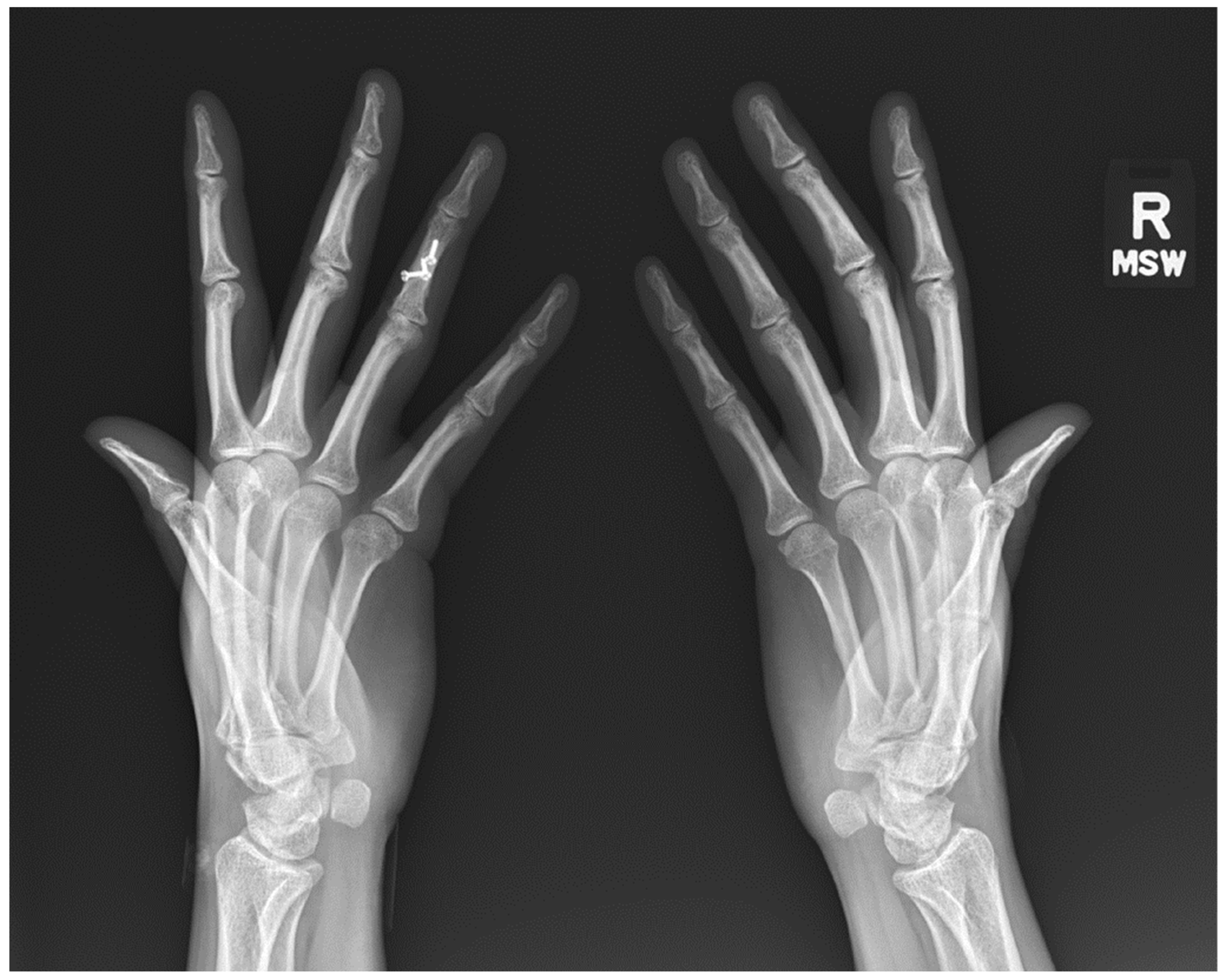  Diagnostics | Free Full-Text | Radiographic Findings of Inflammatory ...