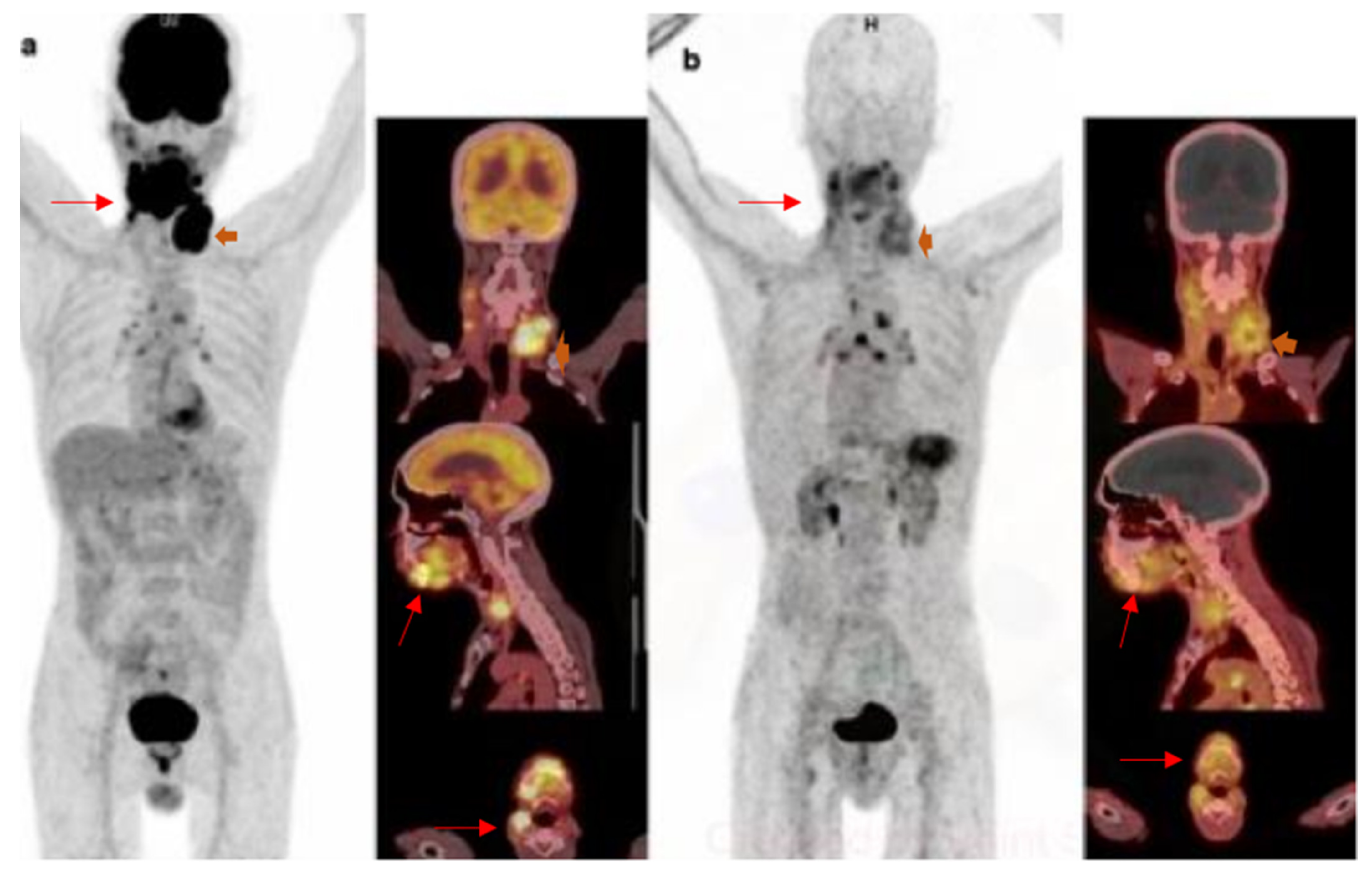 Diagnostics 12 02135 g002
