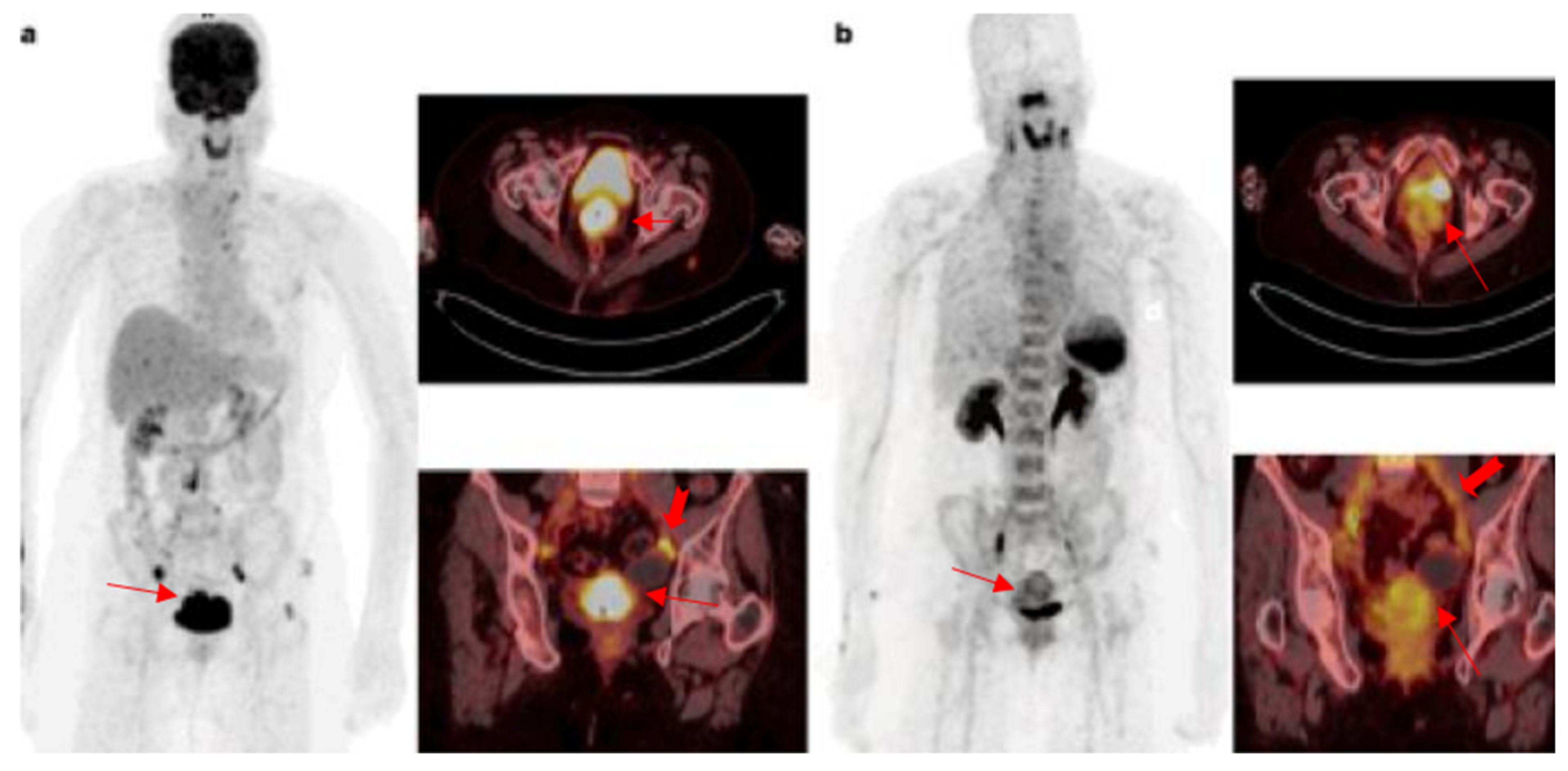 Diagnostics 12 02135 g003