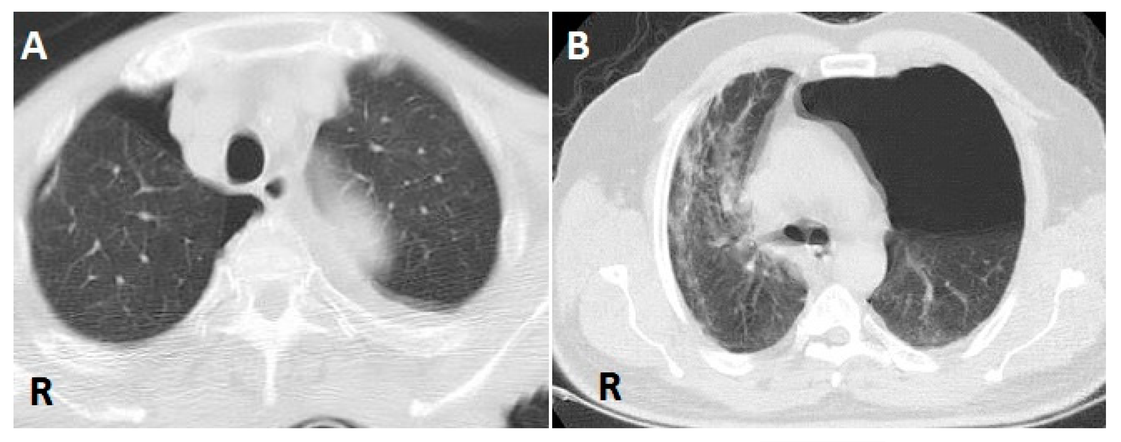 Diagnostics 12 02140 g001 550