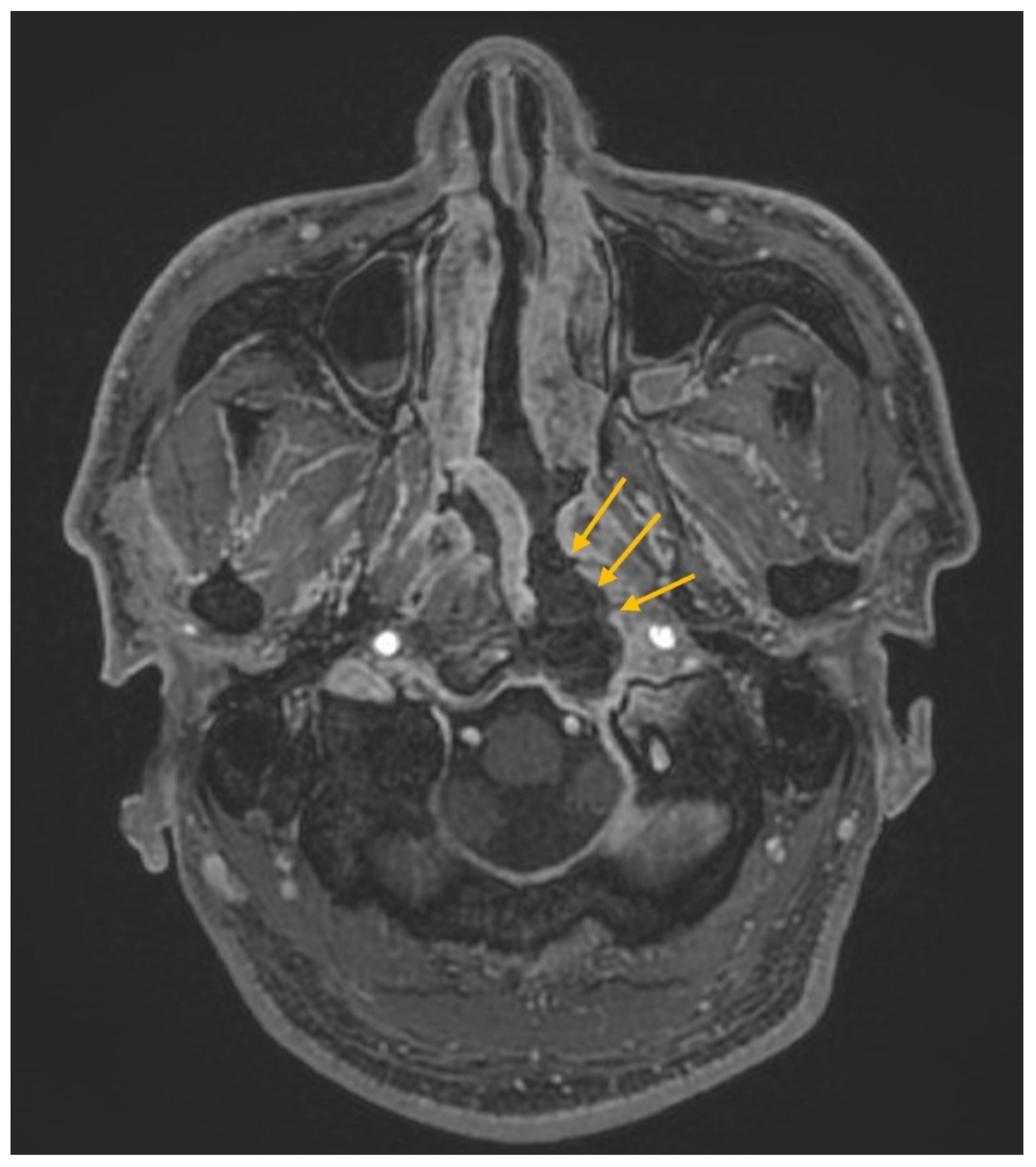 Diagnostics 12 02145 g005 Diagnostics 12 02145 g005