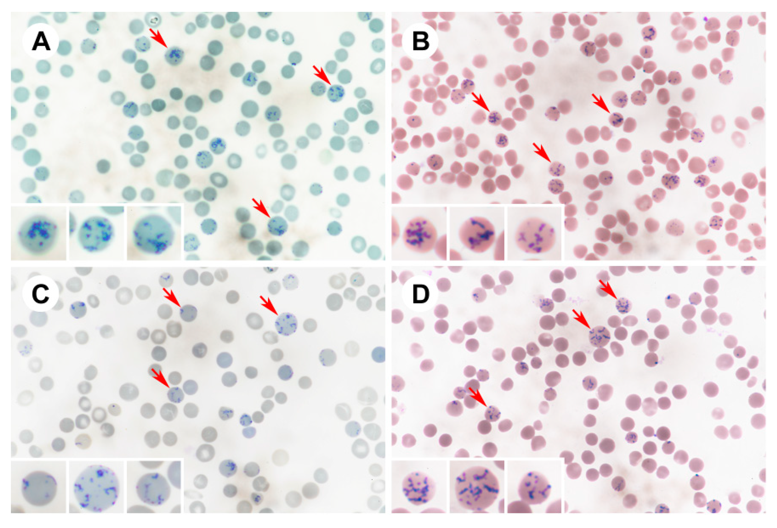 Impact of Staining Methods and Human Factors on Accuracy of Manual ...