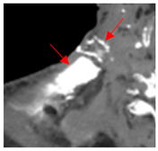 Diagnostics 12 02156 i004