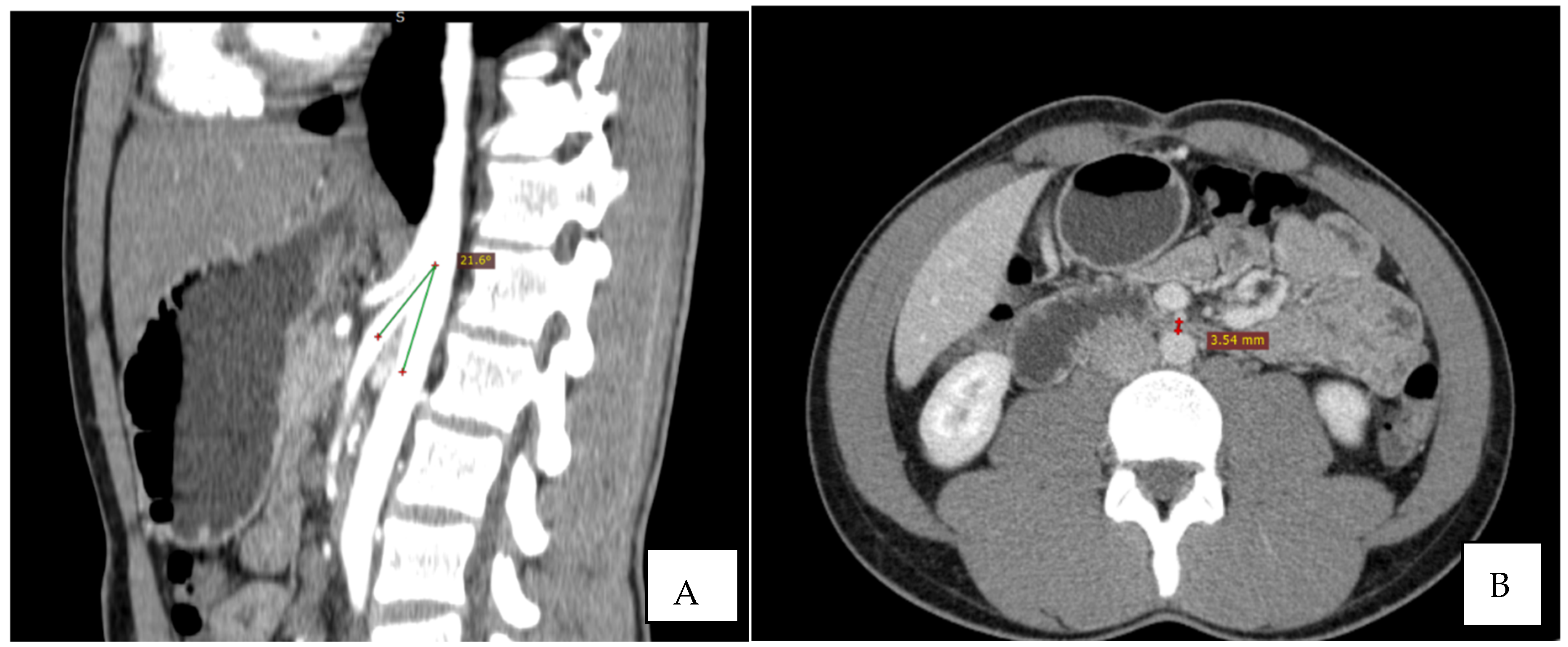 Diagnostics 12 02159 g003 550