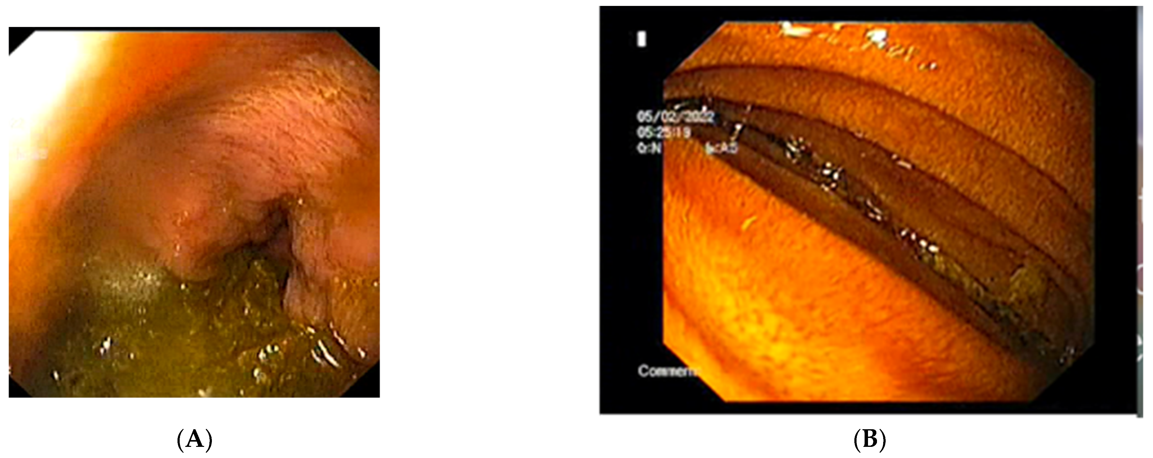 Diagnostics 12 02159 g004 550