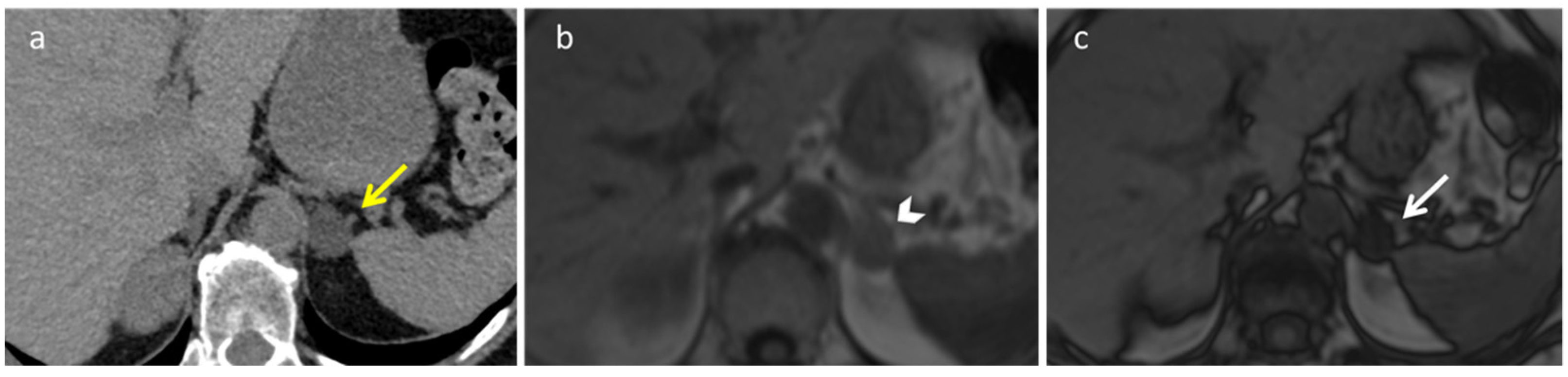 Diagnostics 12 02171 g001