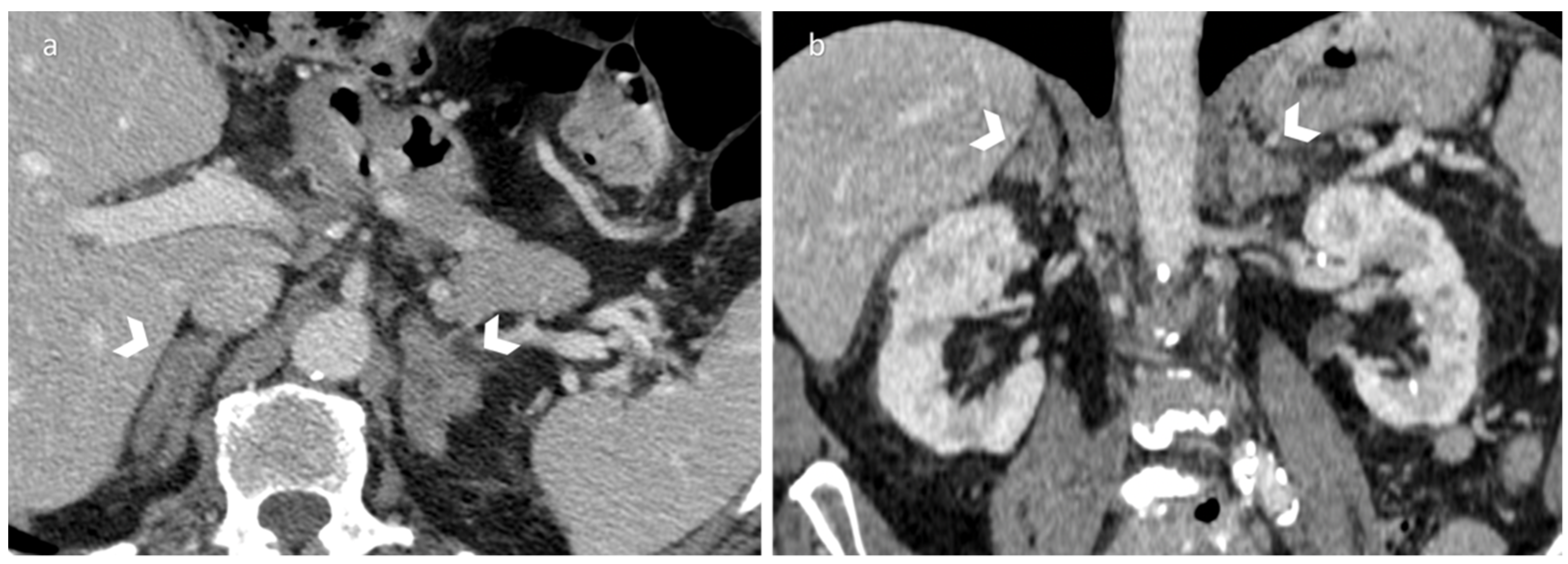 Diagnostics 12 02171 g003