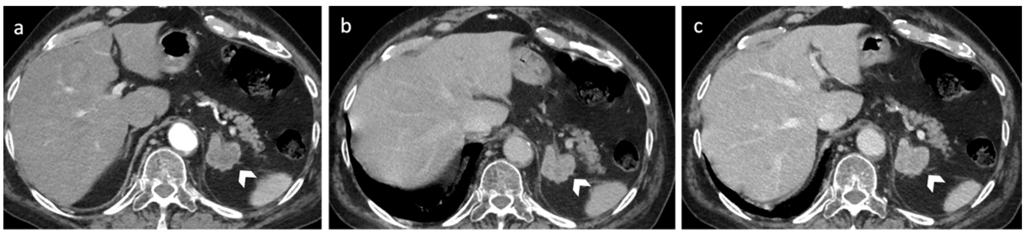 Diagnostics 12 02171 g007