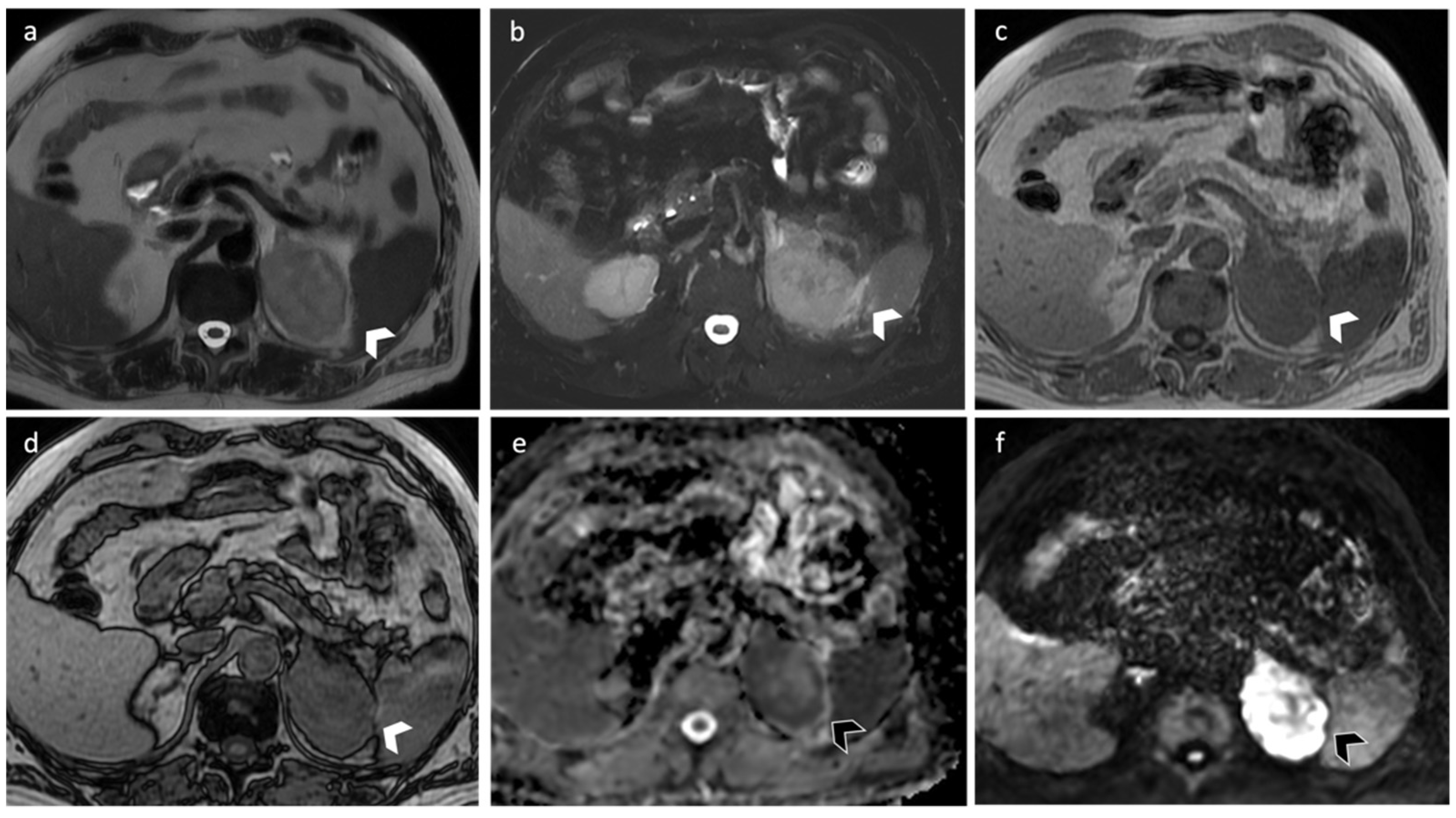 Diagnostics 12 02171 g008