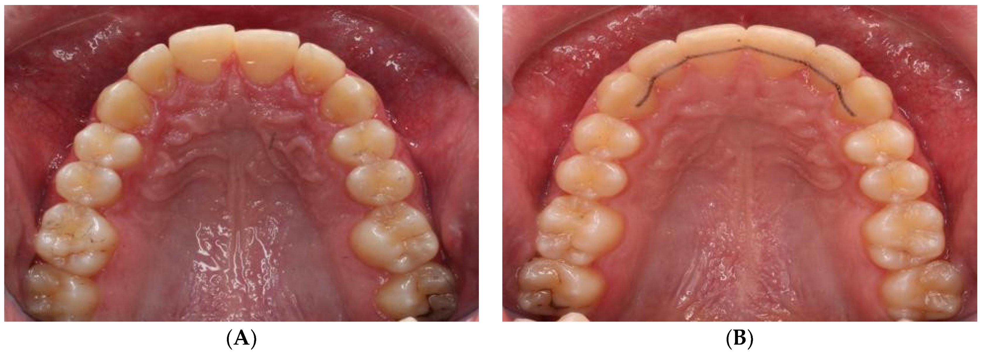 Diagnostics 12 02176 g0a2a 550