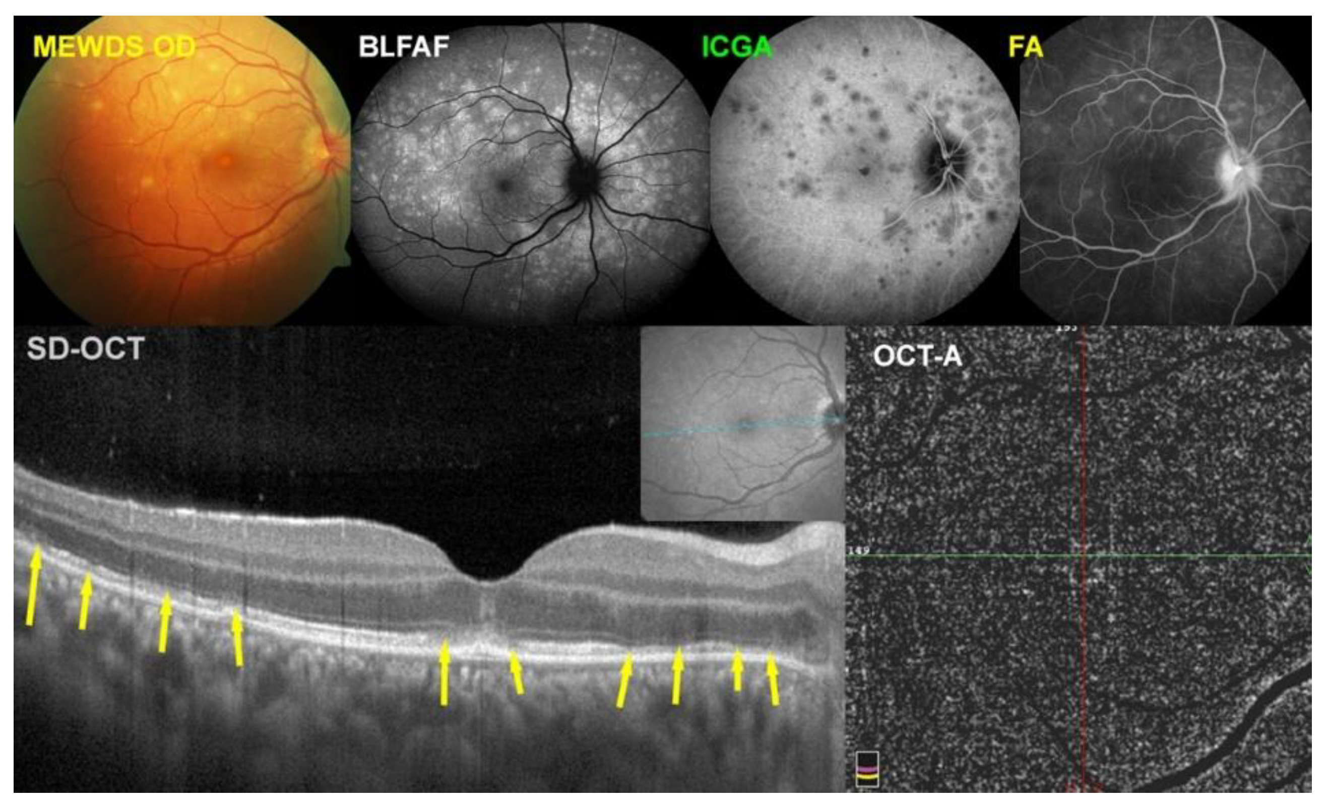 Diagnostics 12 02179 g004 Diagnostics 12 02179 g004