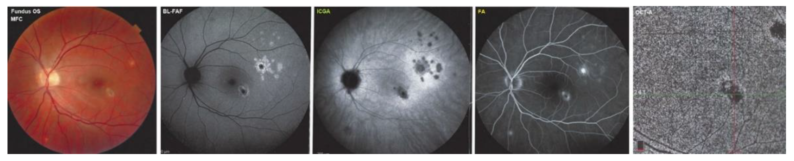 Diagnostics 12 02179 g006 Diagnostics 12 02179 g006