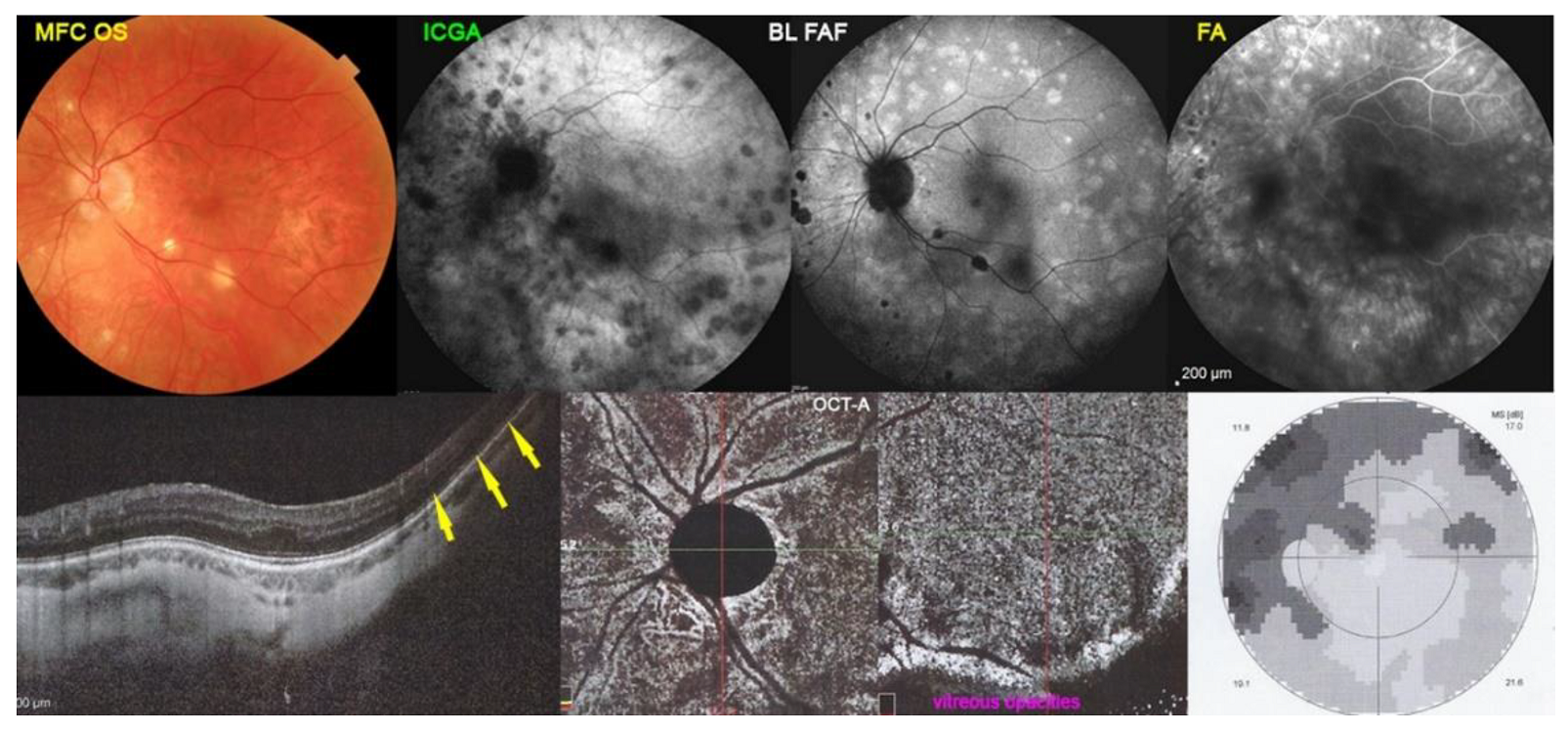 Diagnostics 12 02179 g007 Diagnostics 12 02179 g007