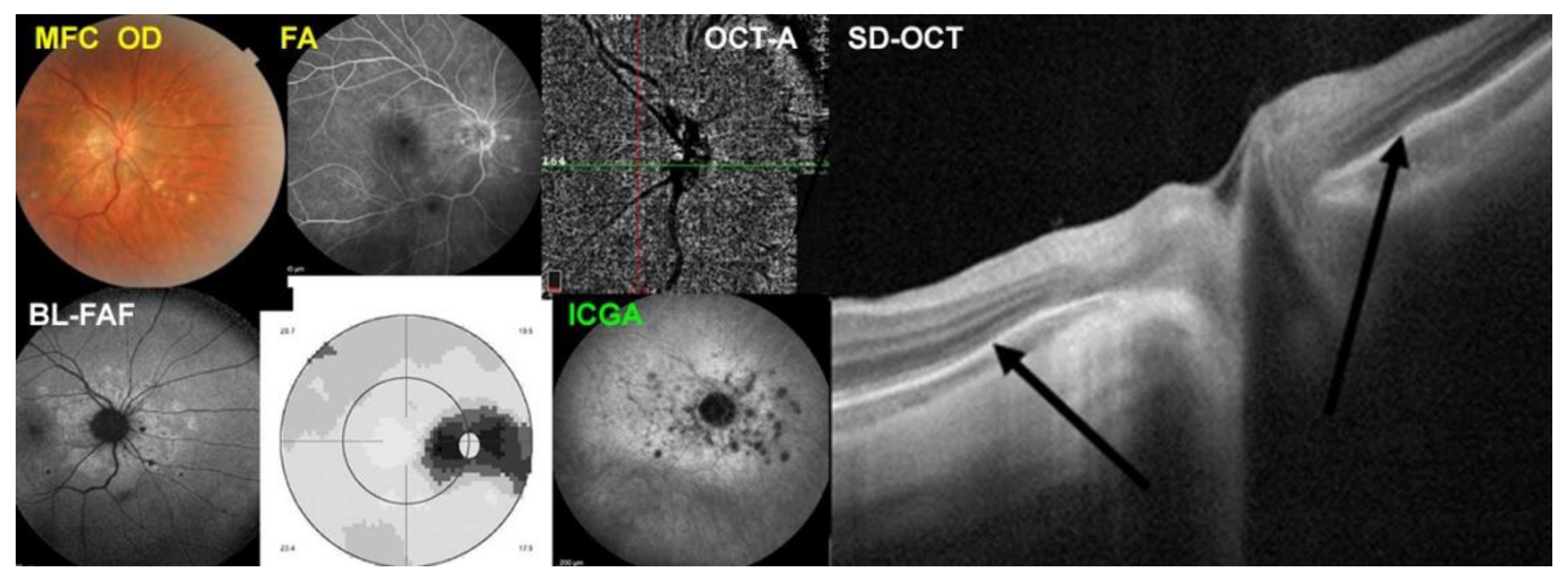 Diagnostics 12 02179 g008 Diagnostics 12 02179 g008