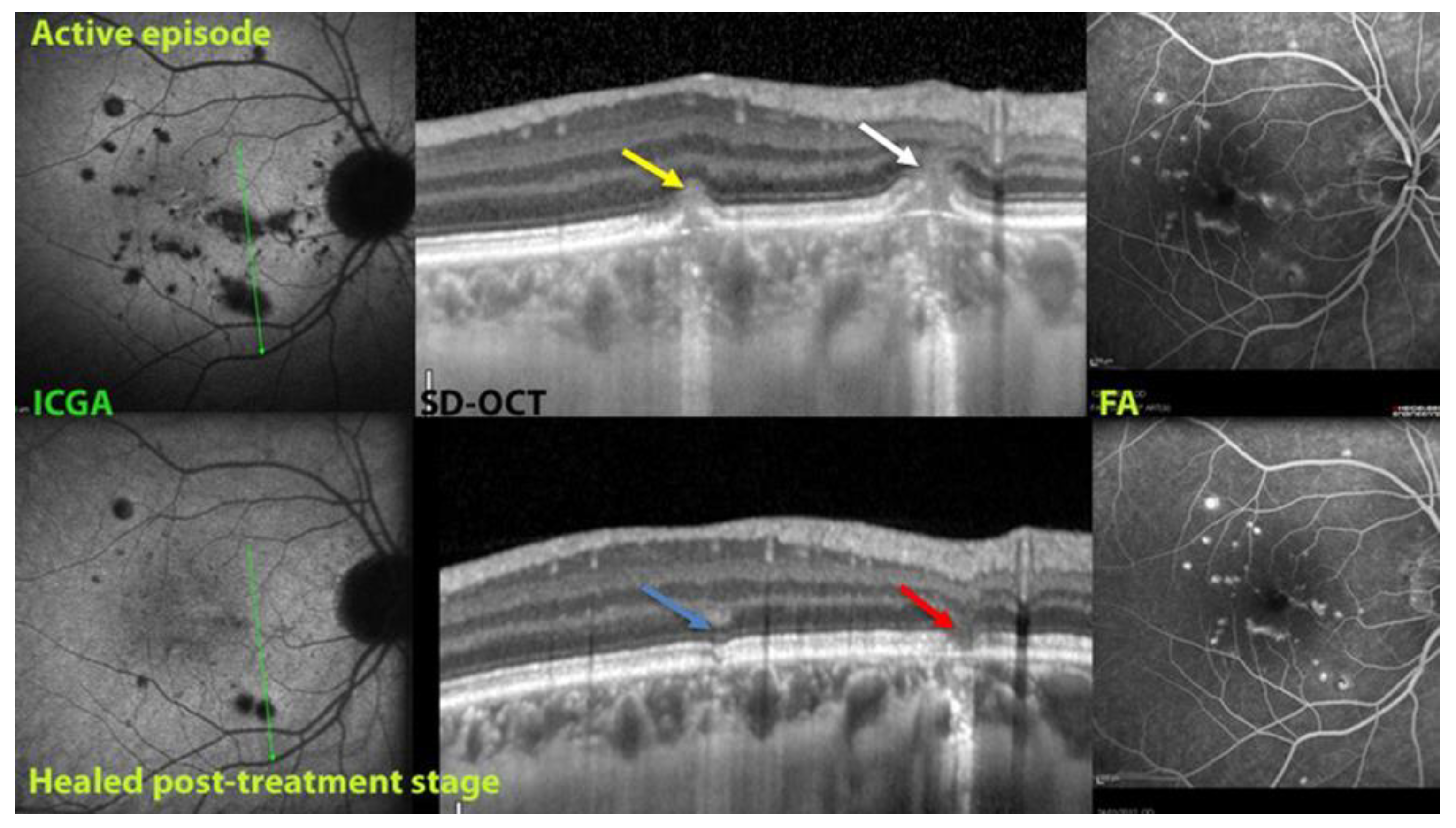 Diagnostics 12 02179 g009 Diagnostics 12 02179 g009