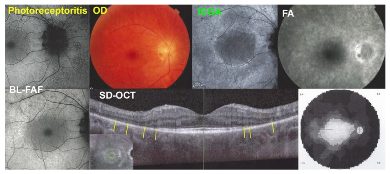 Diagnostics 12 02179 g010 Diagnostics 12 02179 g010