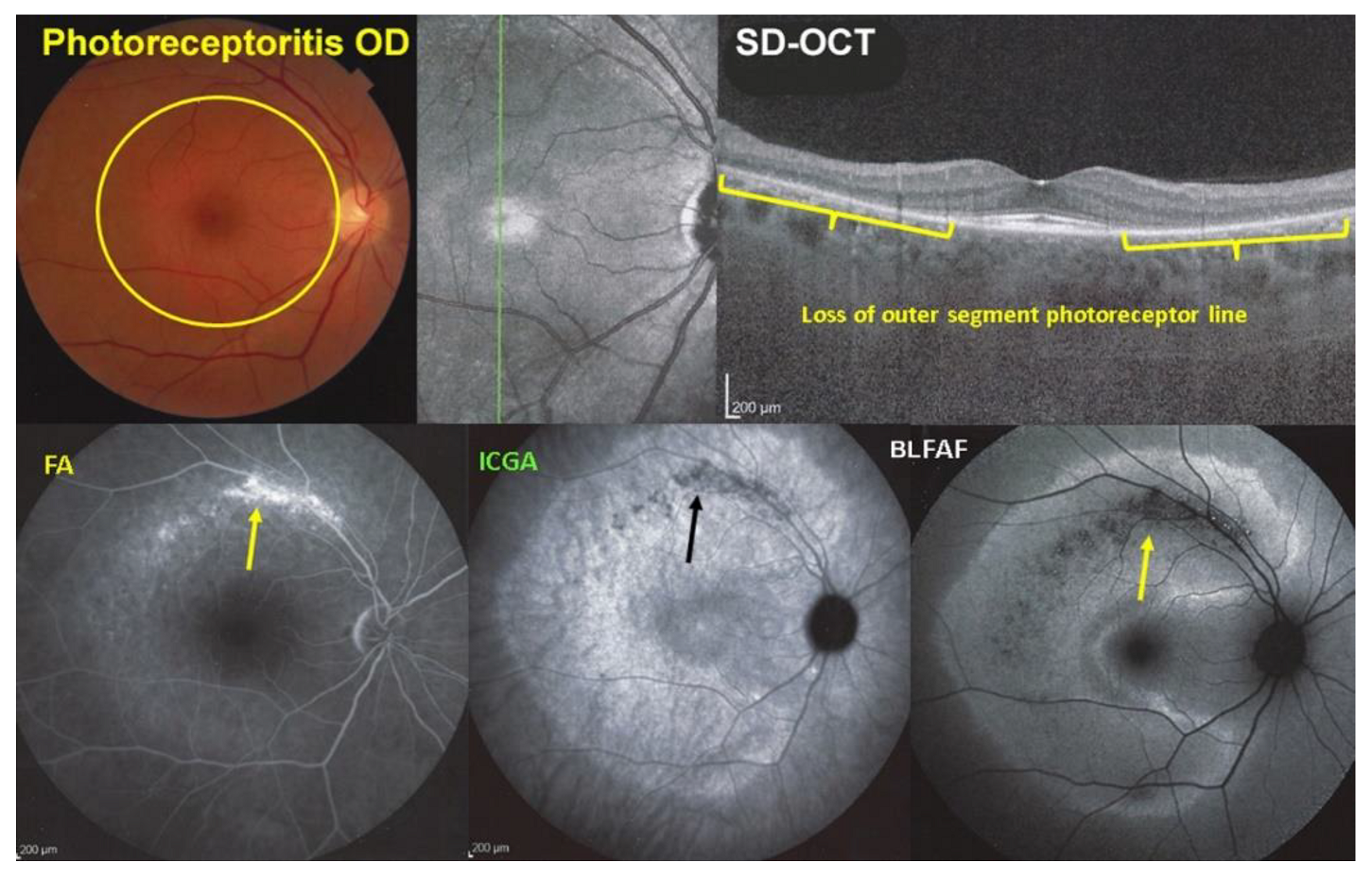 Diagnostics 12 02179 g011 Diagnostics 12 02179 g011