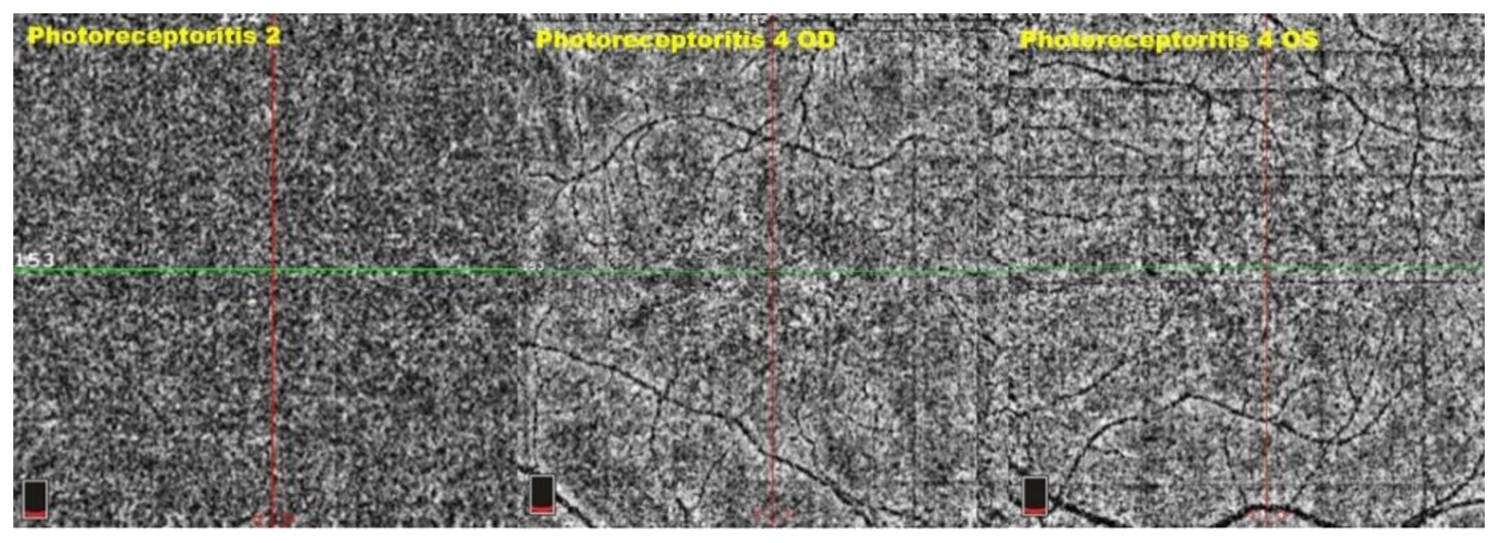 Diagnostics 12 02179 g015 Diagnostics 12 02179 g015