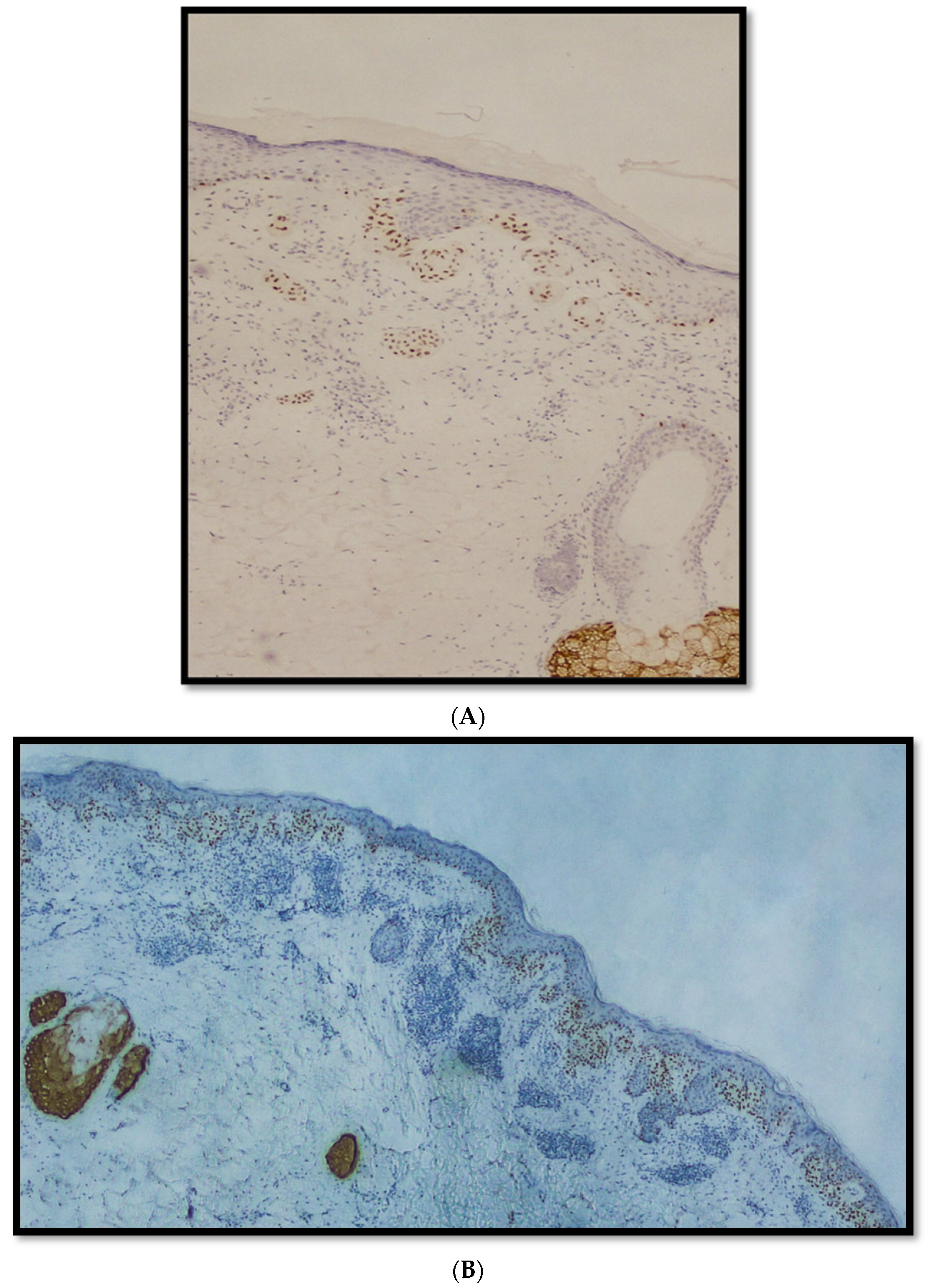 Diagnostics 12 02197 g001a 550
