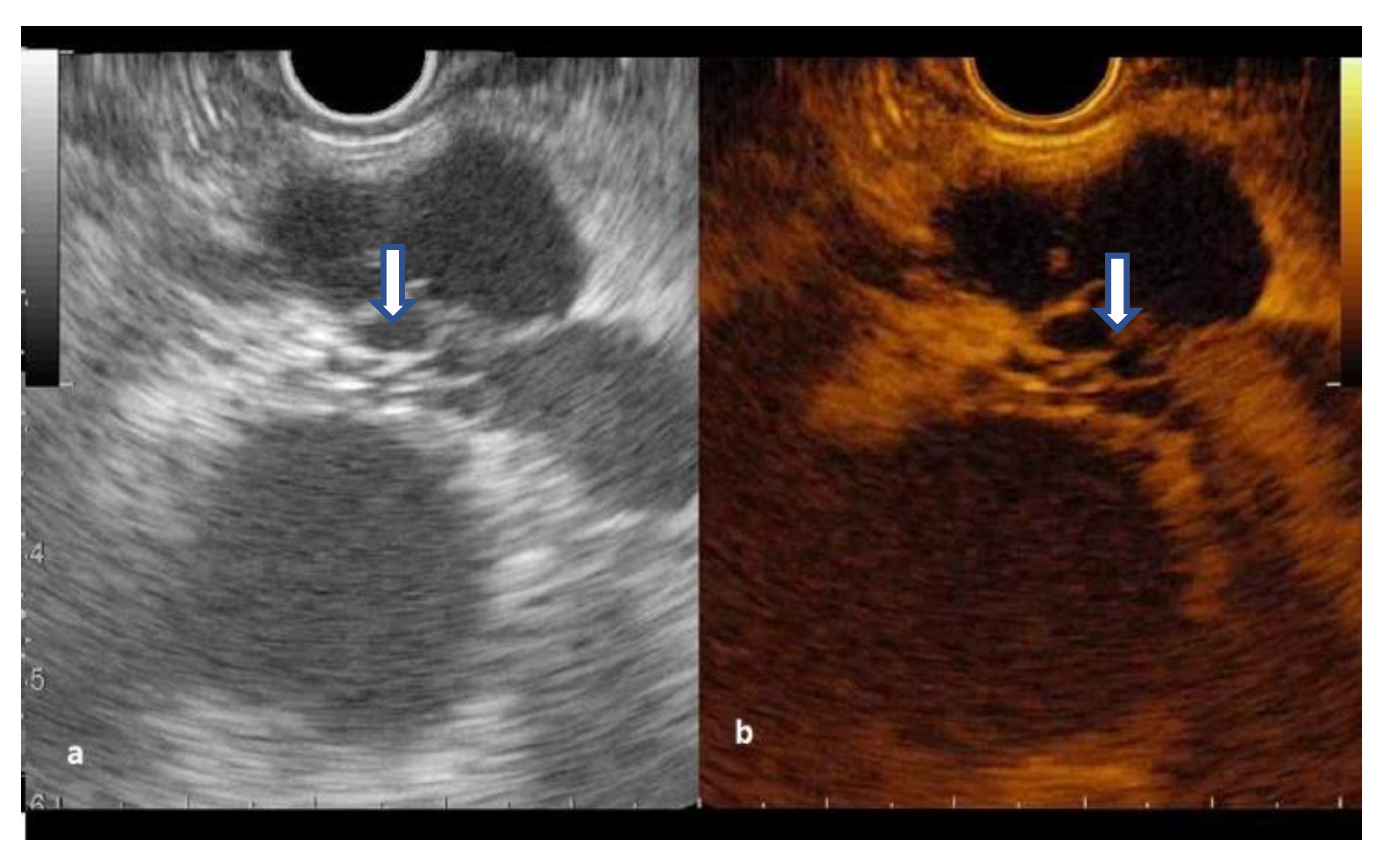 Diagnostics 12 02209 g003