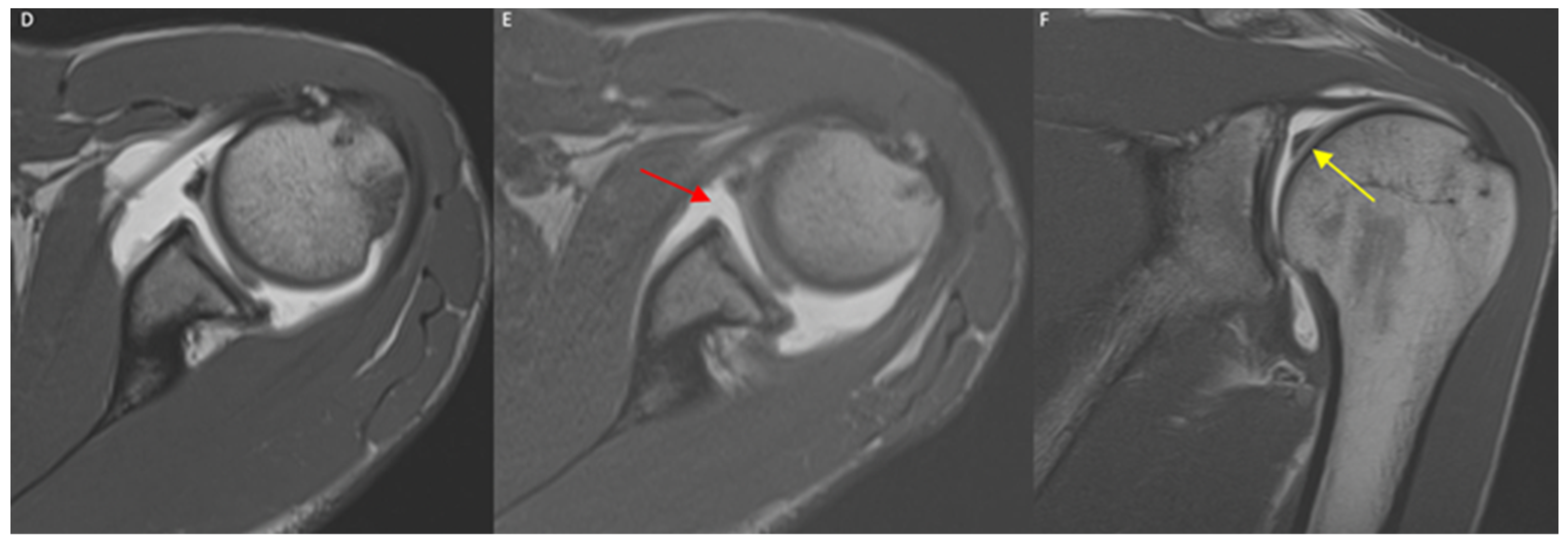 Diagnostics 12 02230 g006b 550