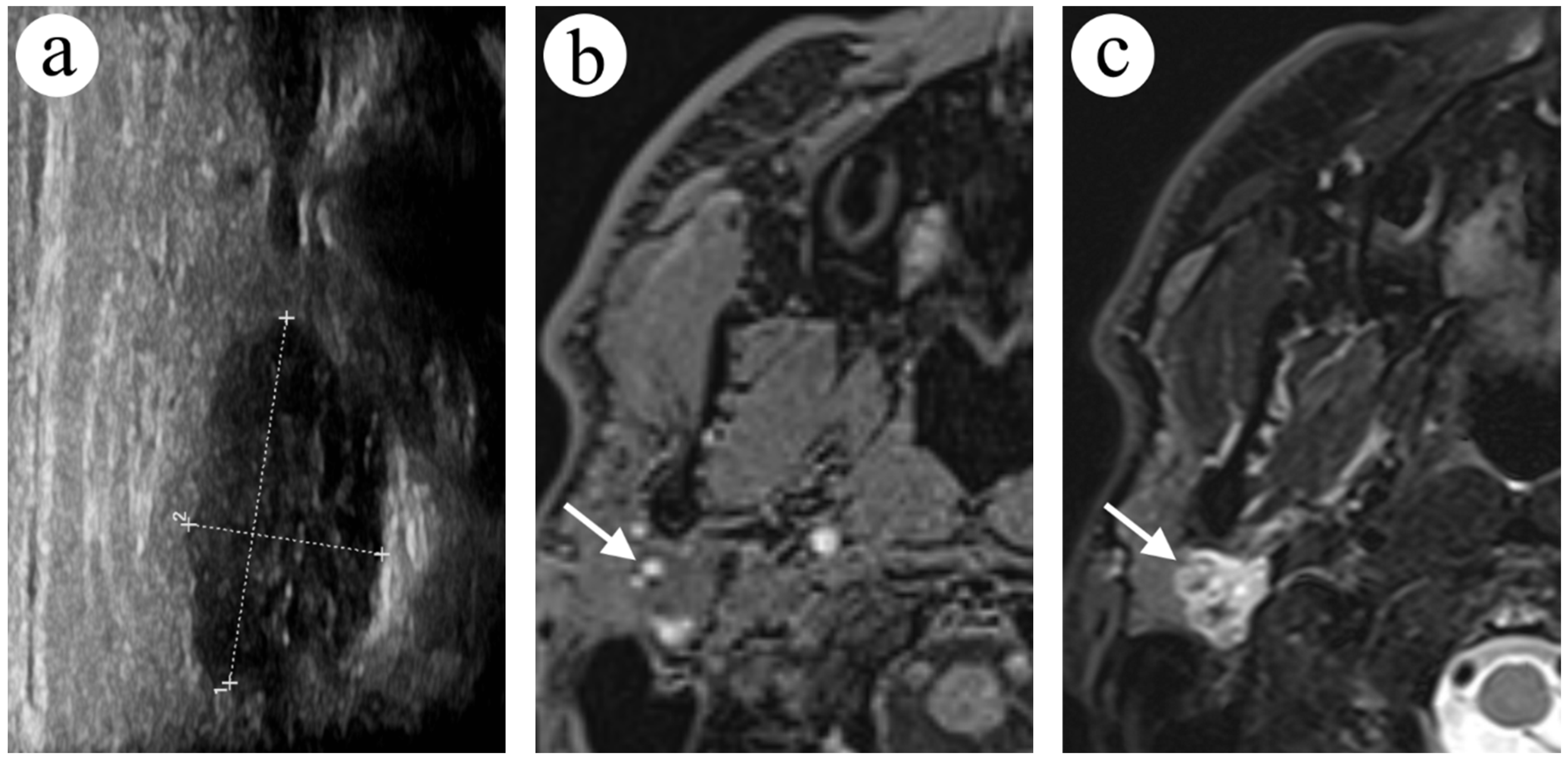 Diagnostics 12 02236 g003a Diagnostics 12 02236 g003a
