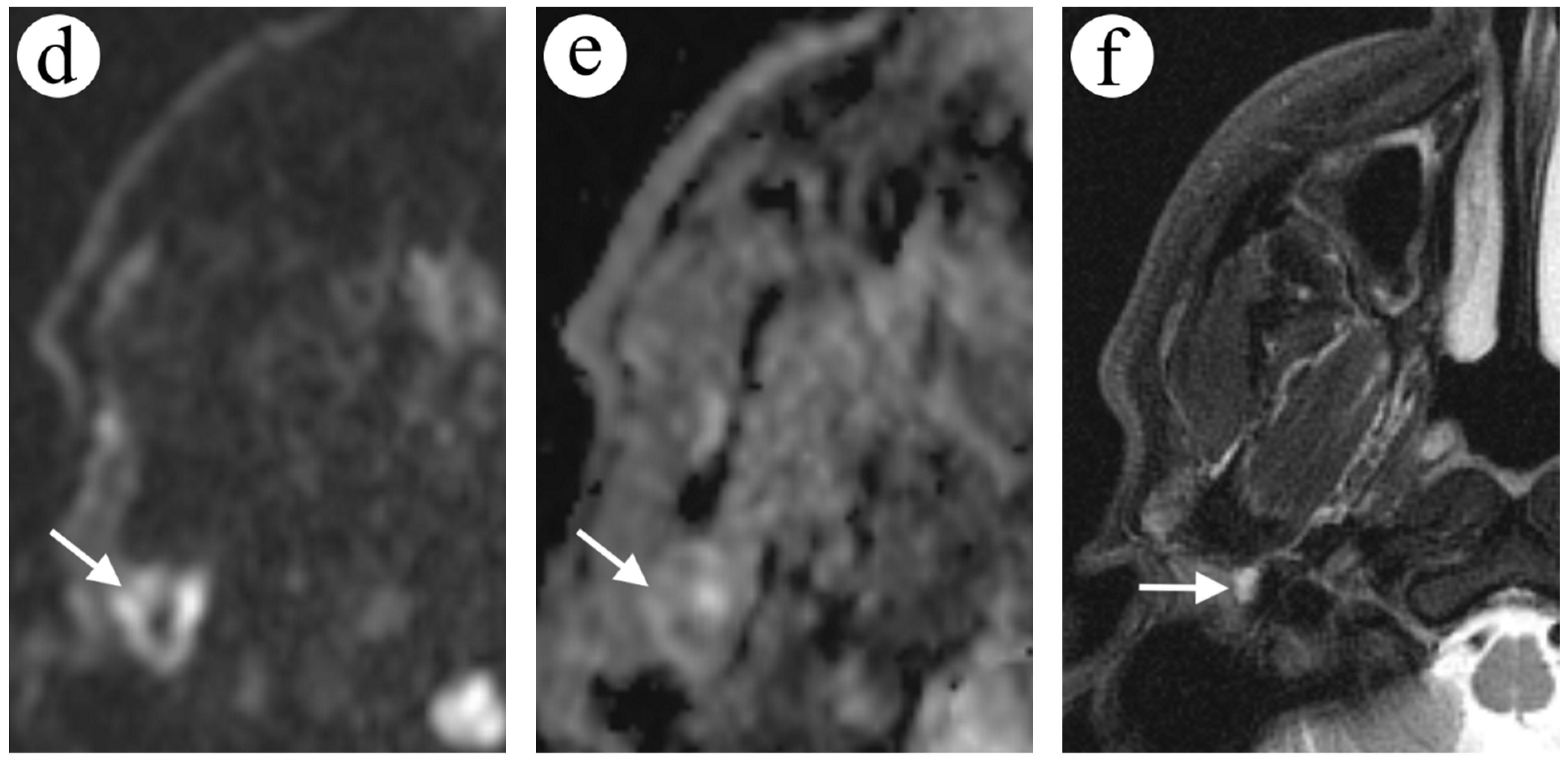 Diagnostics 12 02236 g003b Diagnostics 12 02236 g003b