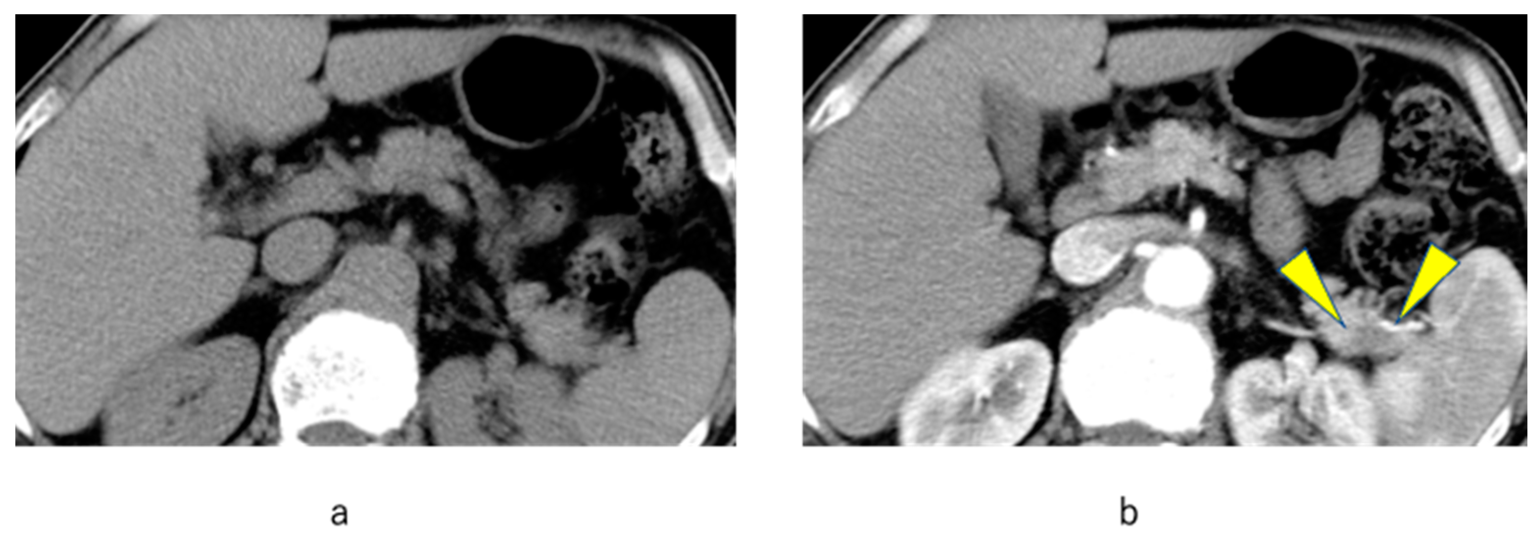 Diagnostics 12 02257 g003 Diagnostics 12 02257 g003