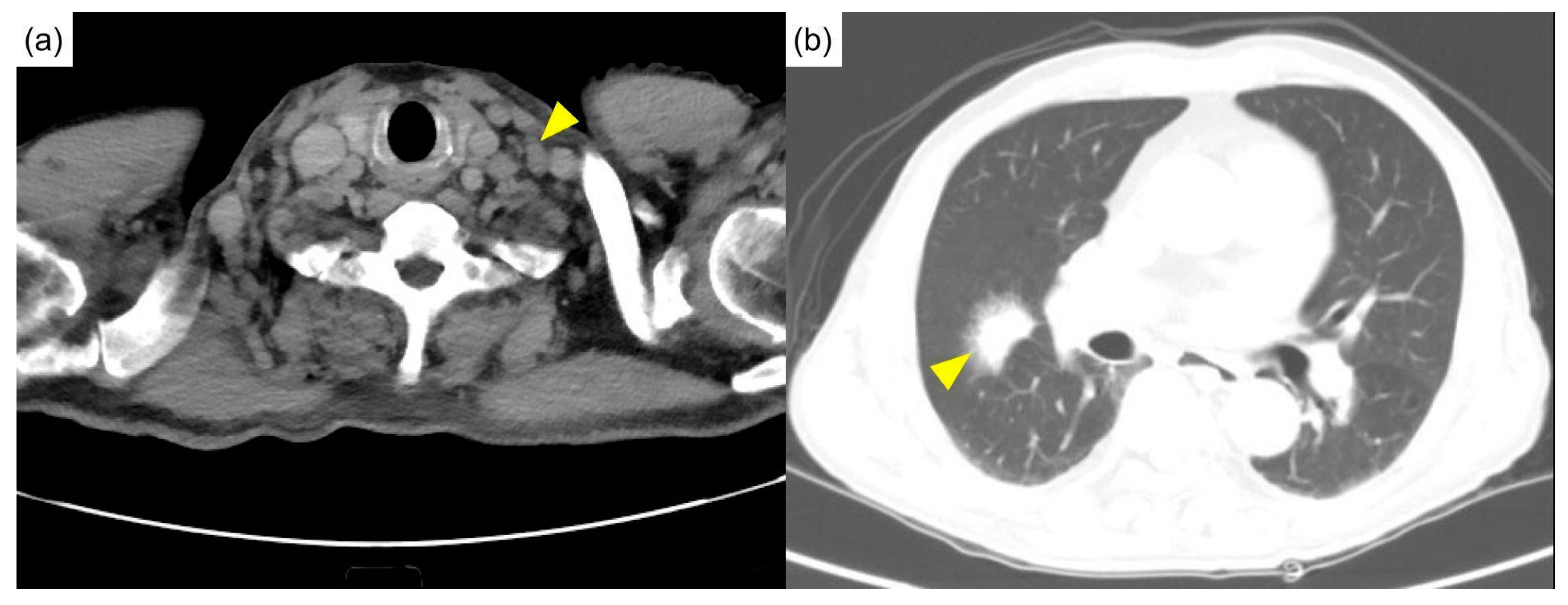 Diagnostics 12 02261 g001 Diagnostics 12 02261 g001