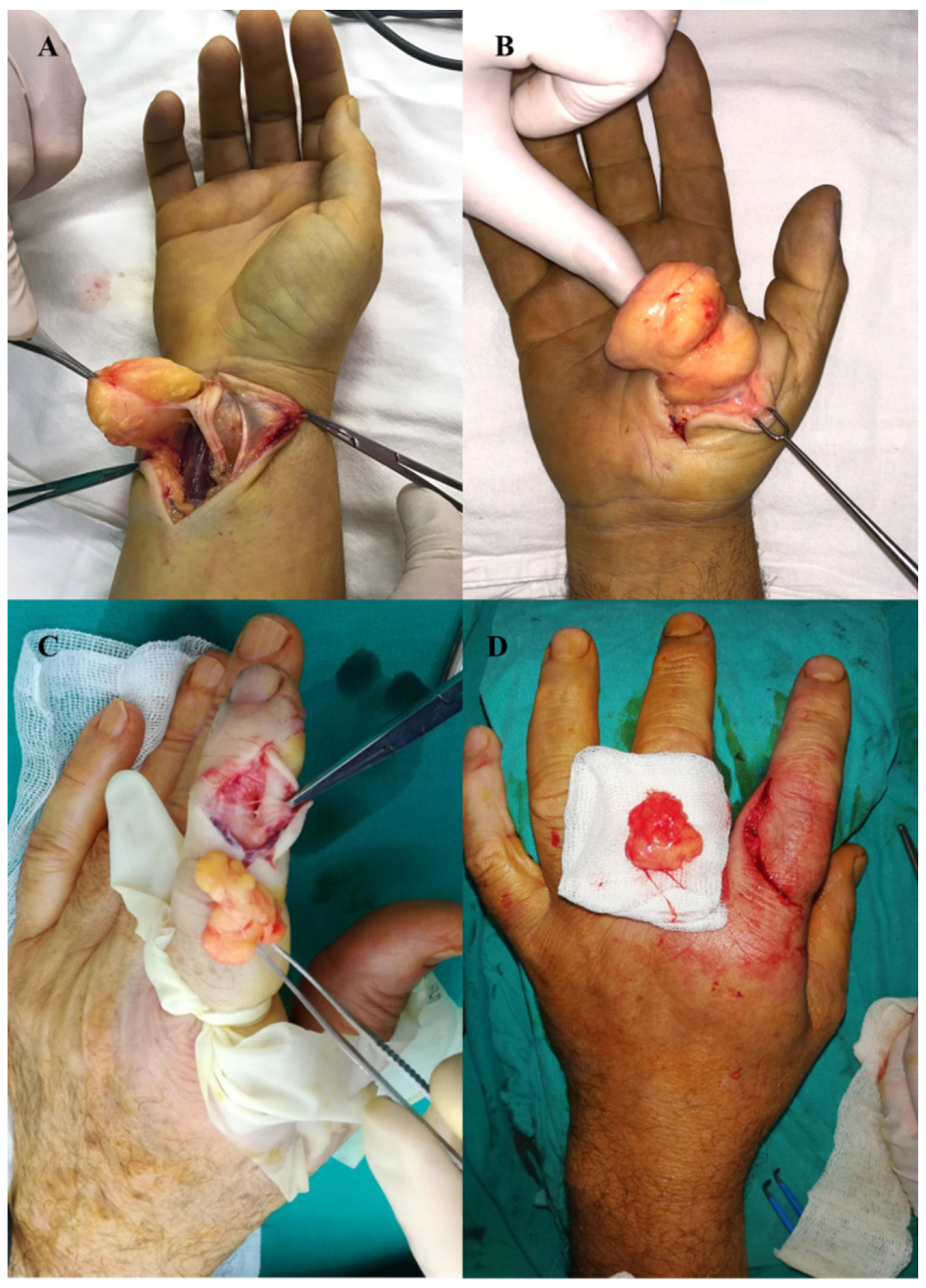 Diagnostics 12 02286 g005 Diagnostics 12 02286 g005