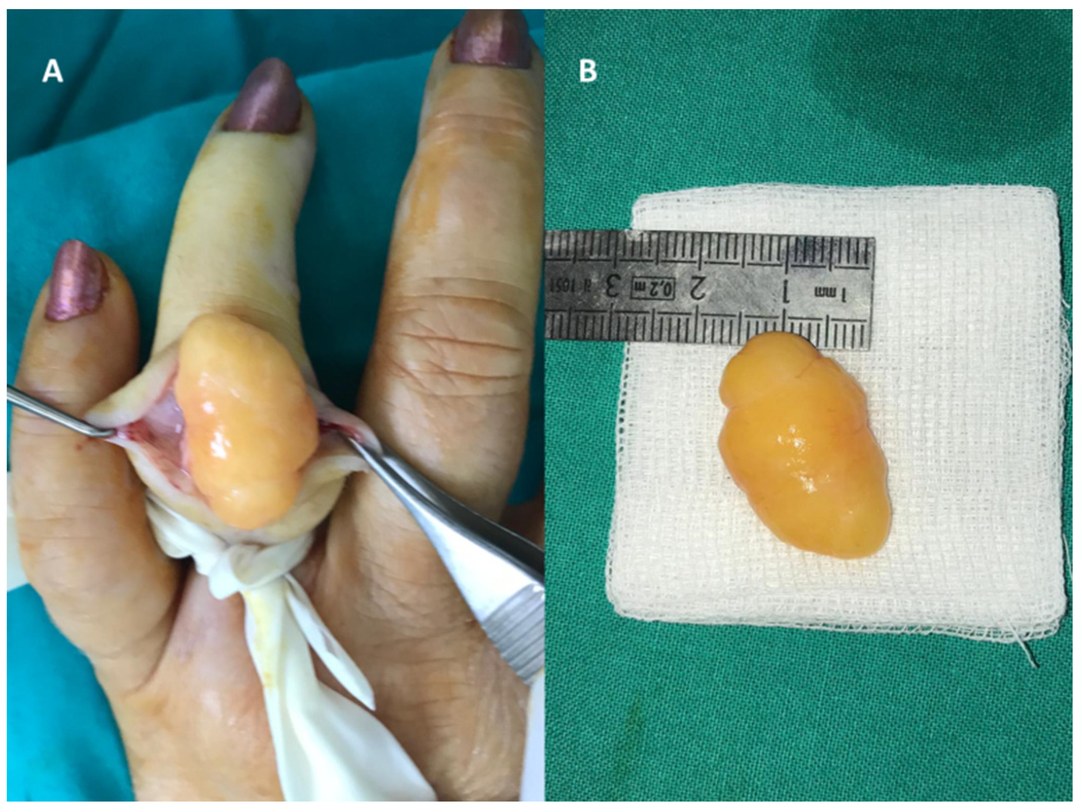 Diagnostics 12 02286 g006 Diagnostics 12 02286 g006