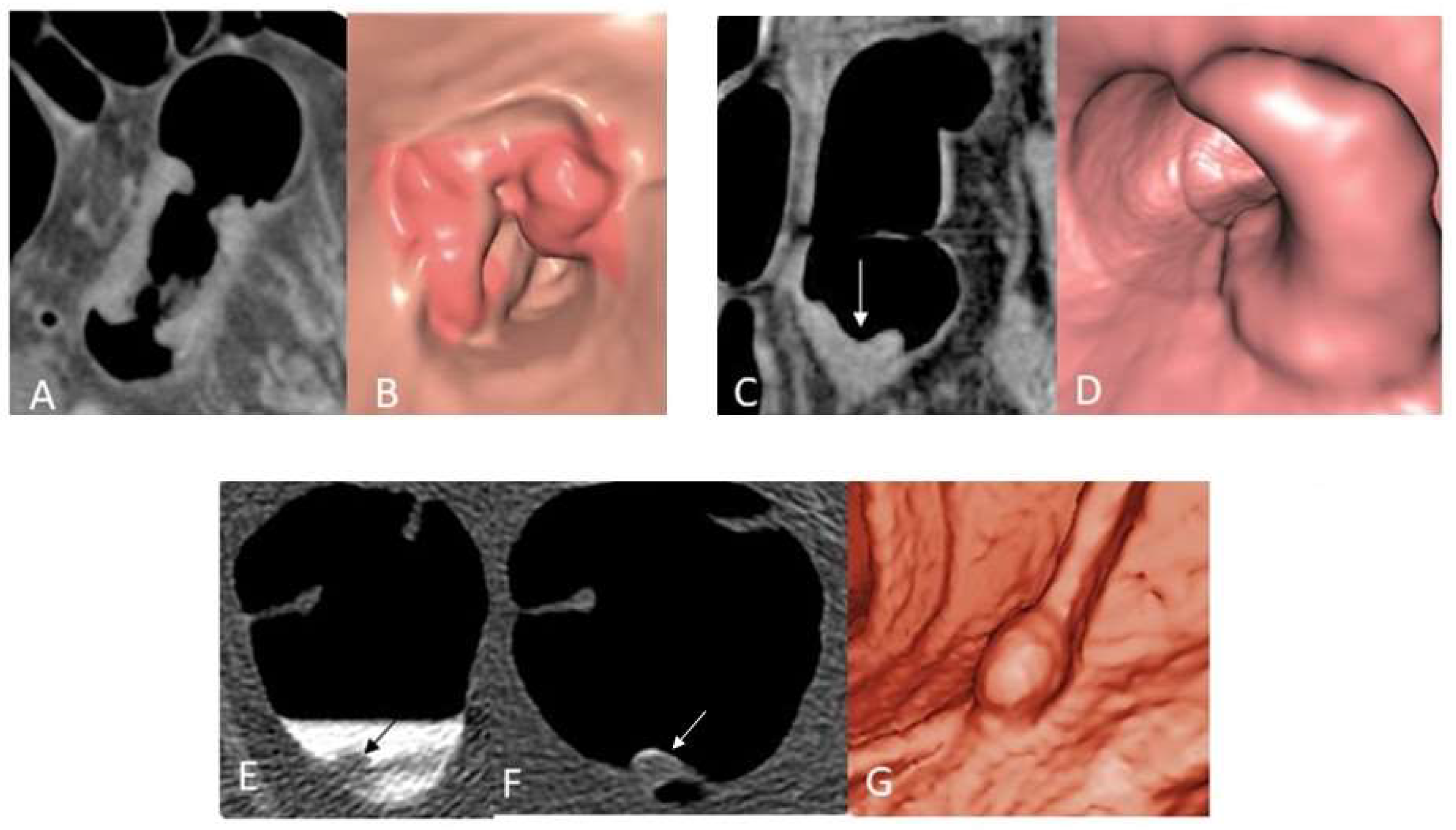 Diagnostics 12 02326 g003 Diagnostics 12 02326 g003