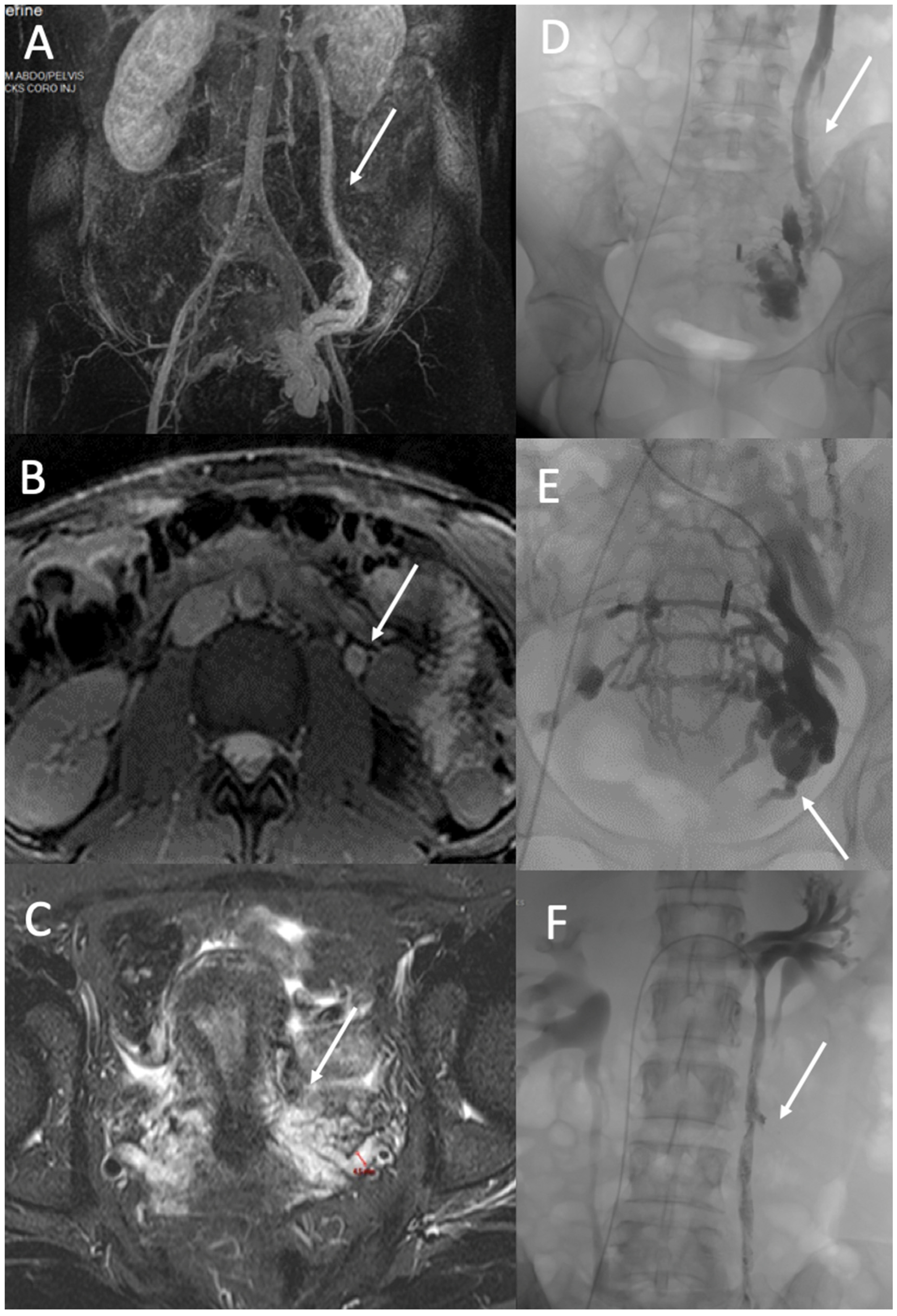 Diagnostics 12 02337 g004 Diagnostics 12 02337 g004