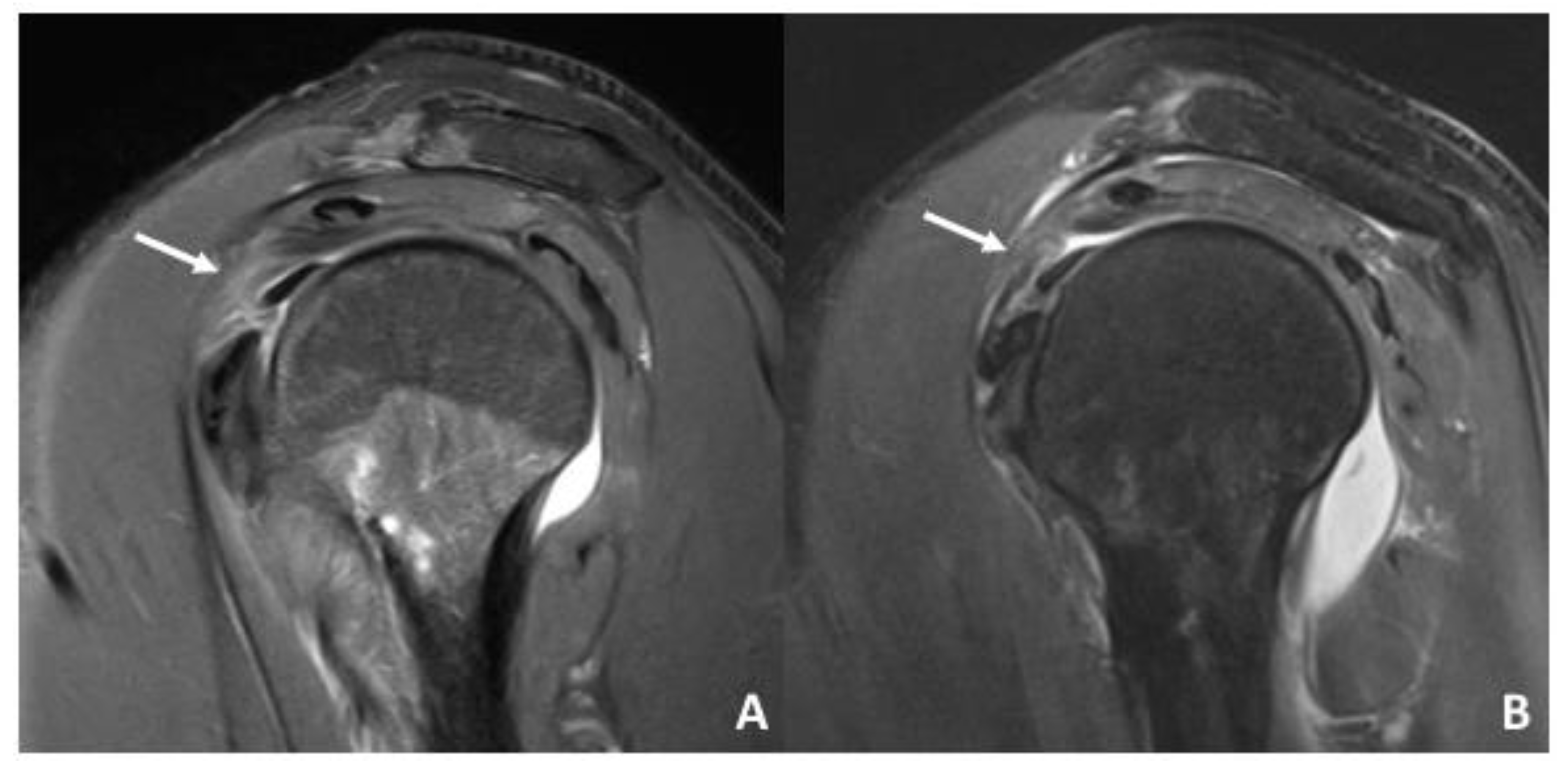 Diagnostics Free FullText Assessment of Acute Lesions of the