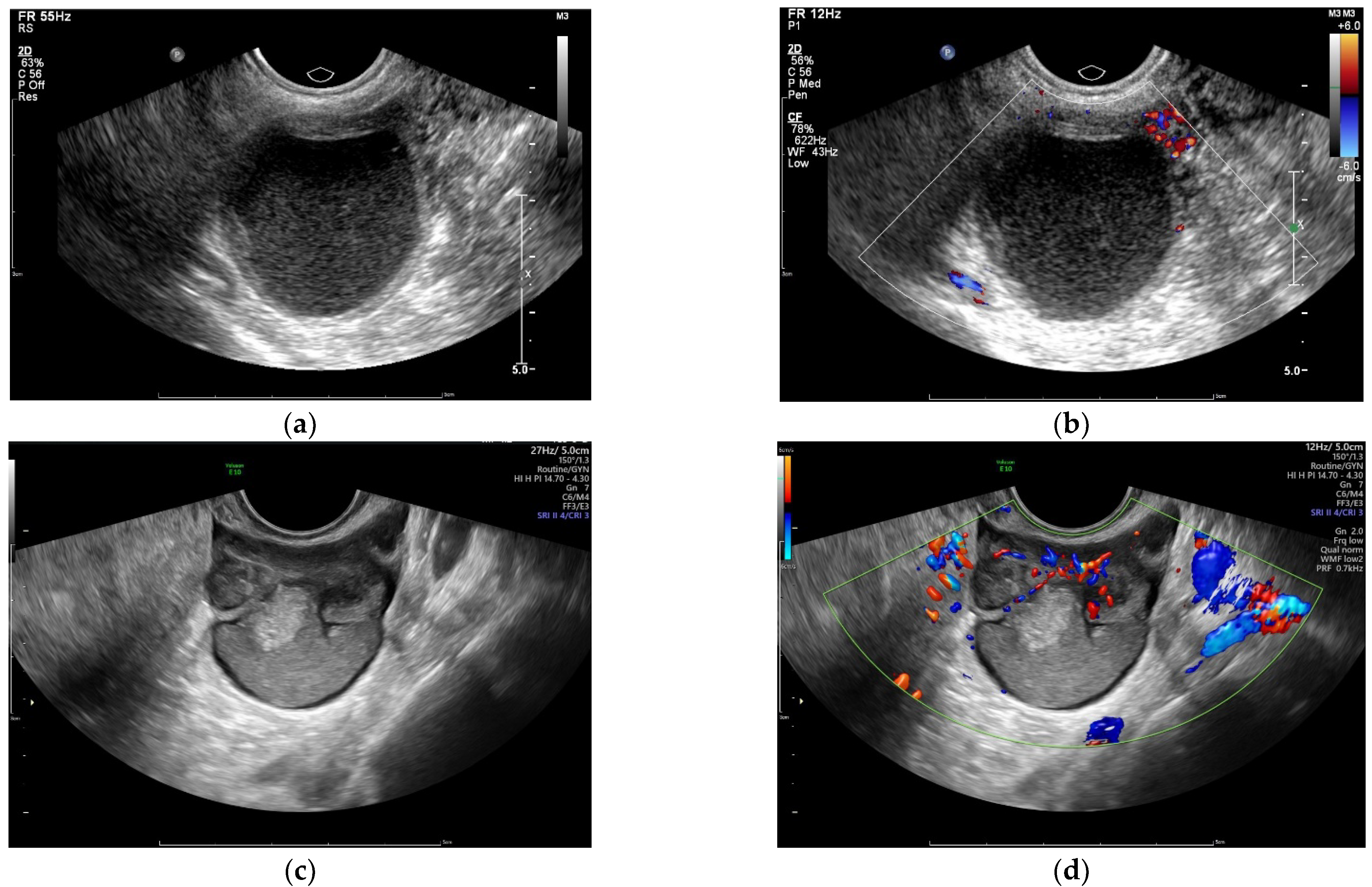 Diagnostics 12 02348 g001 Diagnostics 12 02348 g001
