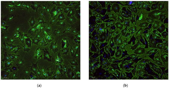 Effects of Laser Application on Alveolar Bone Mesenchymal Stem Cells ...