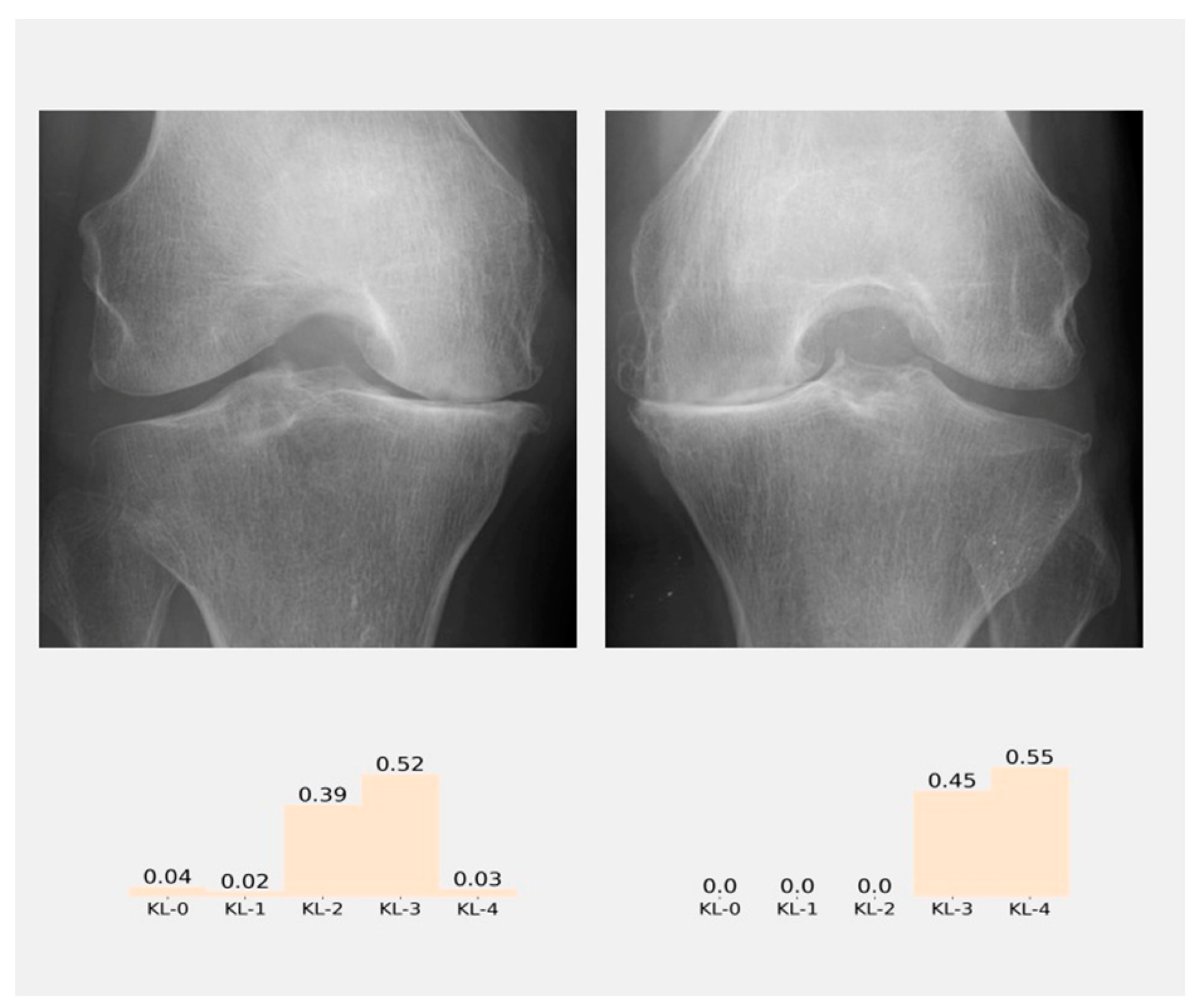 Diagnostics Free FullText Detection and Classification of Knee