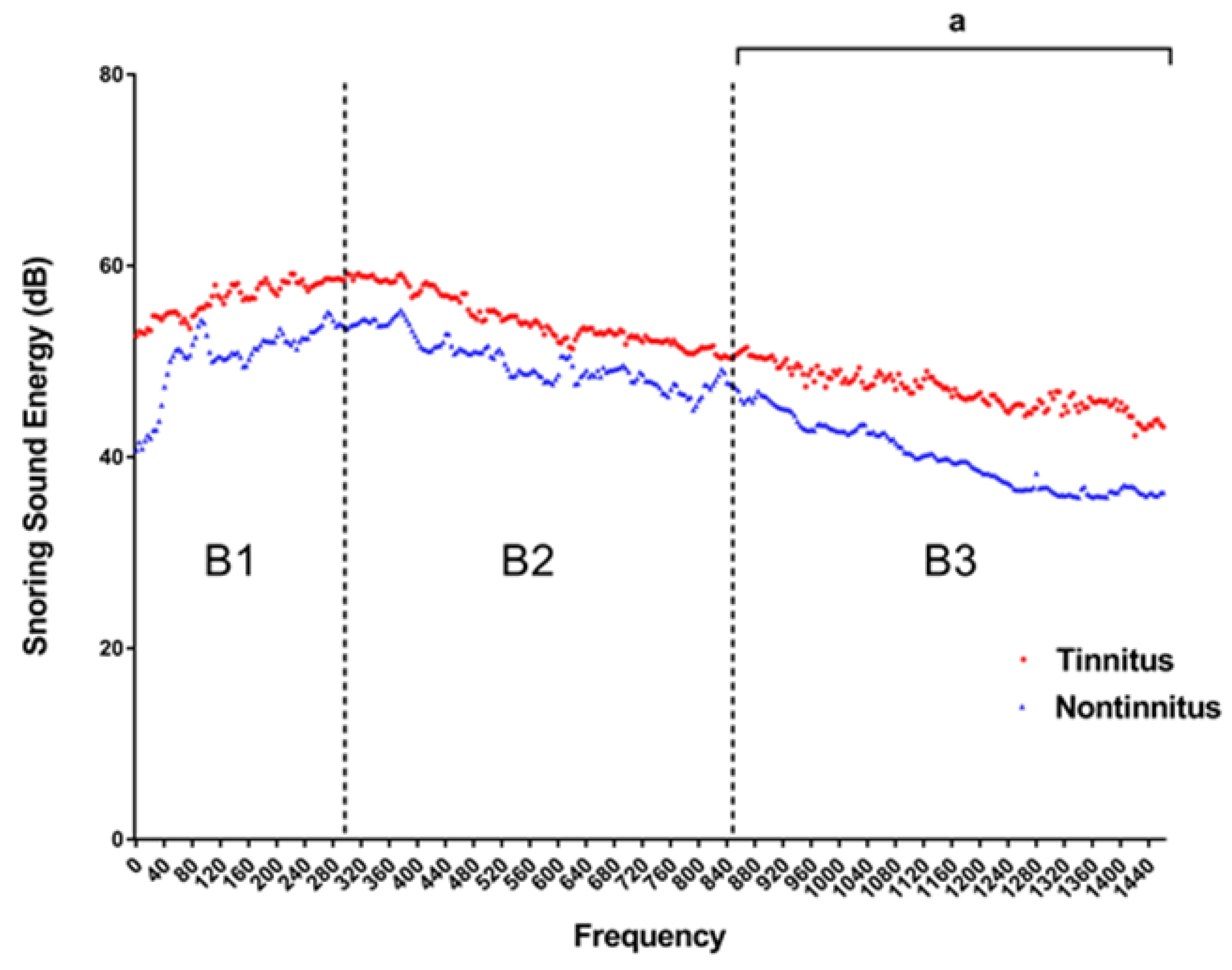 Diagnostics free full text obstructive sleep apnea and auditory