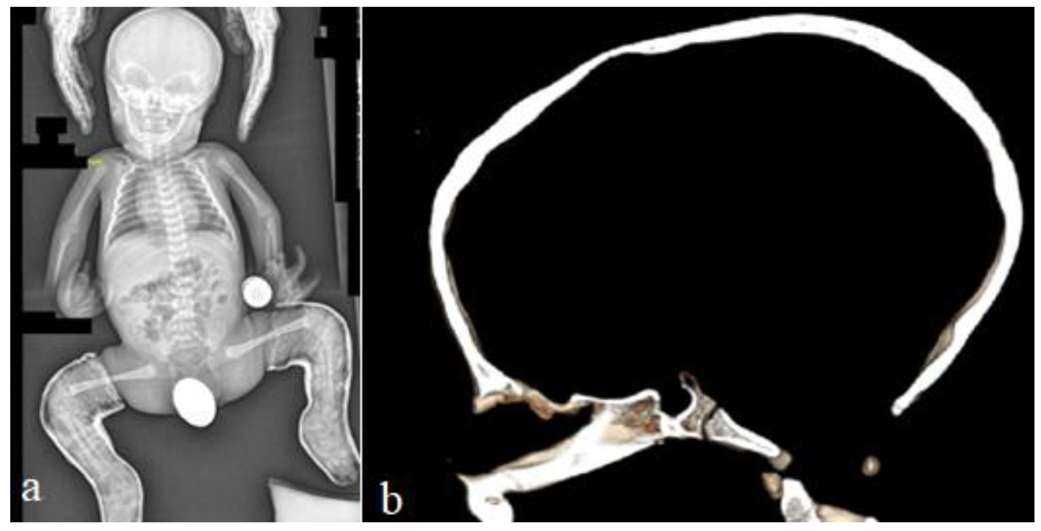 Diagnostics 12 02375 g001
