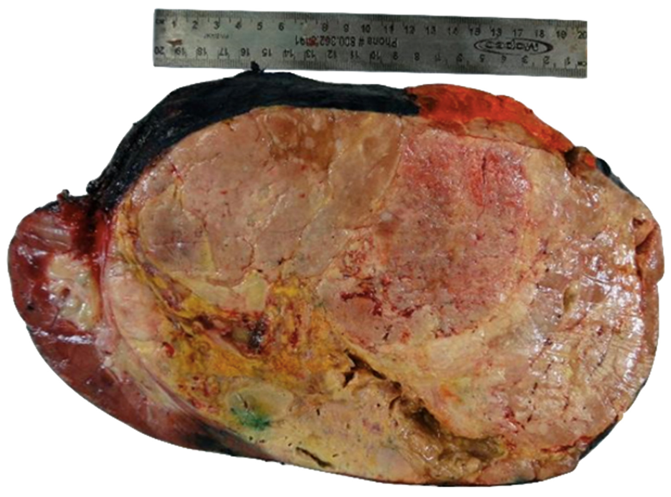 Diagnostics 12 02419 g002 Diagnostics 12 02419 g002