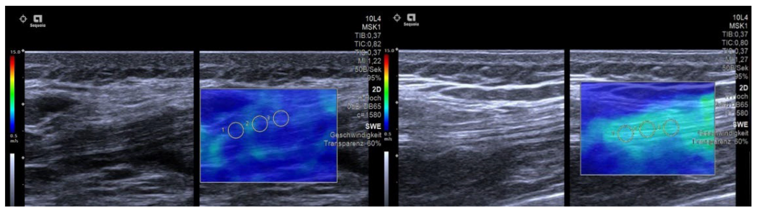 Diagnostics 12 02453 g004 Diagnostics 12 02453 g004