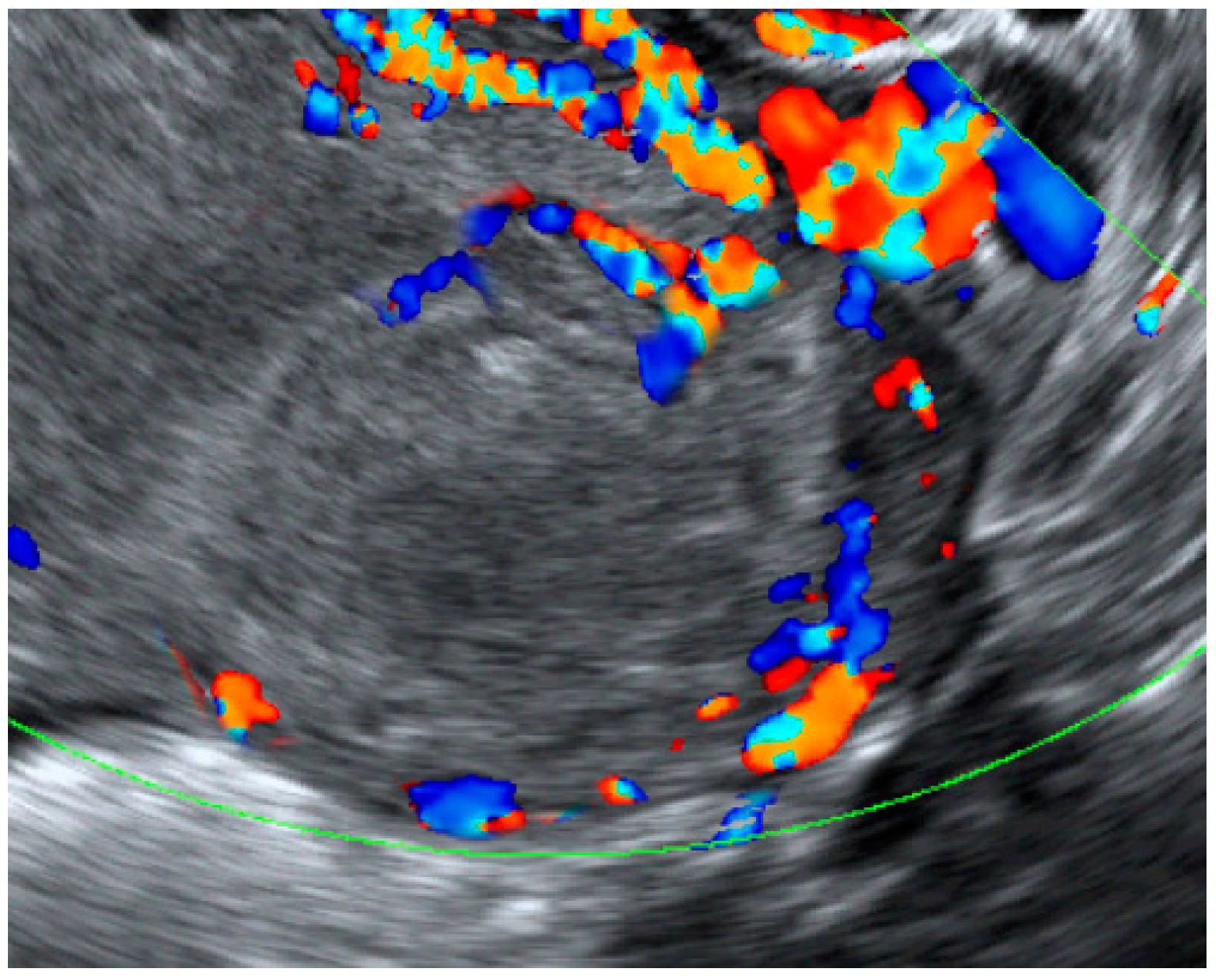 Diagnostics 12 02459 g004 Diagnostics 12 02459 g004