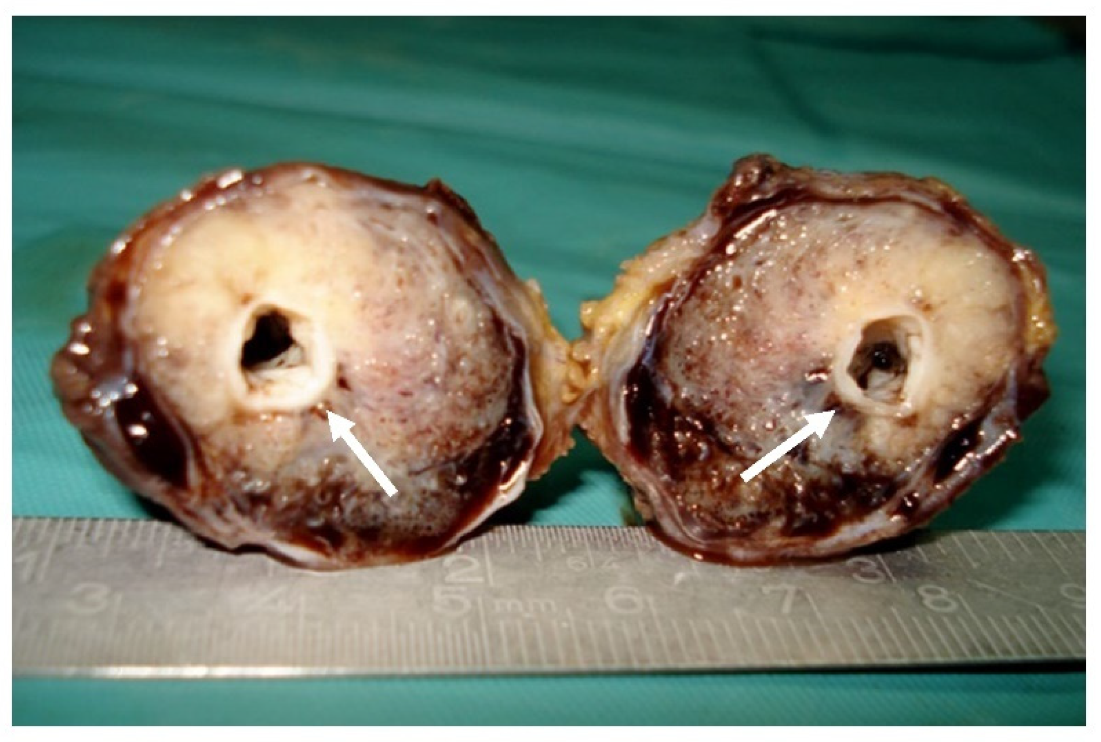 Diagnostics 12 02473 g004 Diagnostics 12 02473 g004